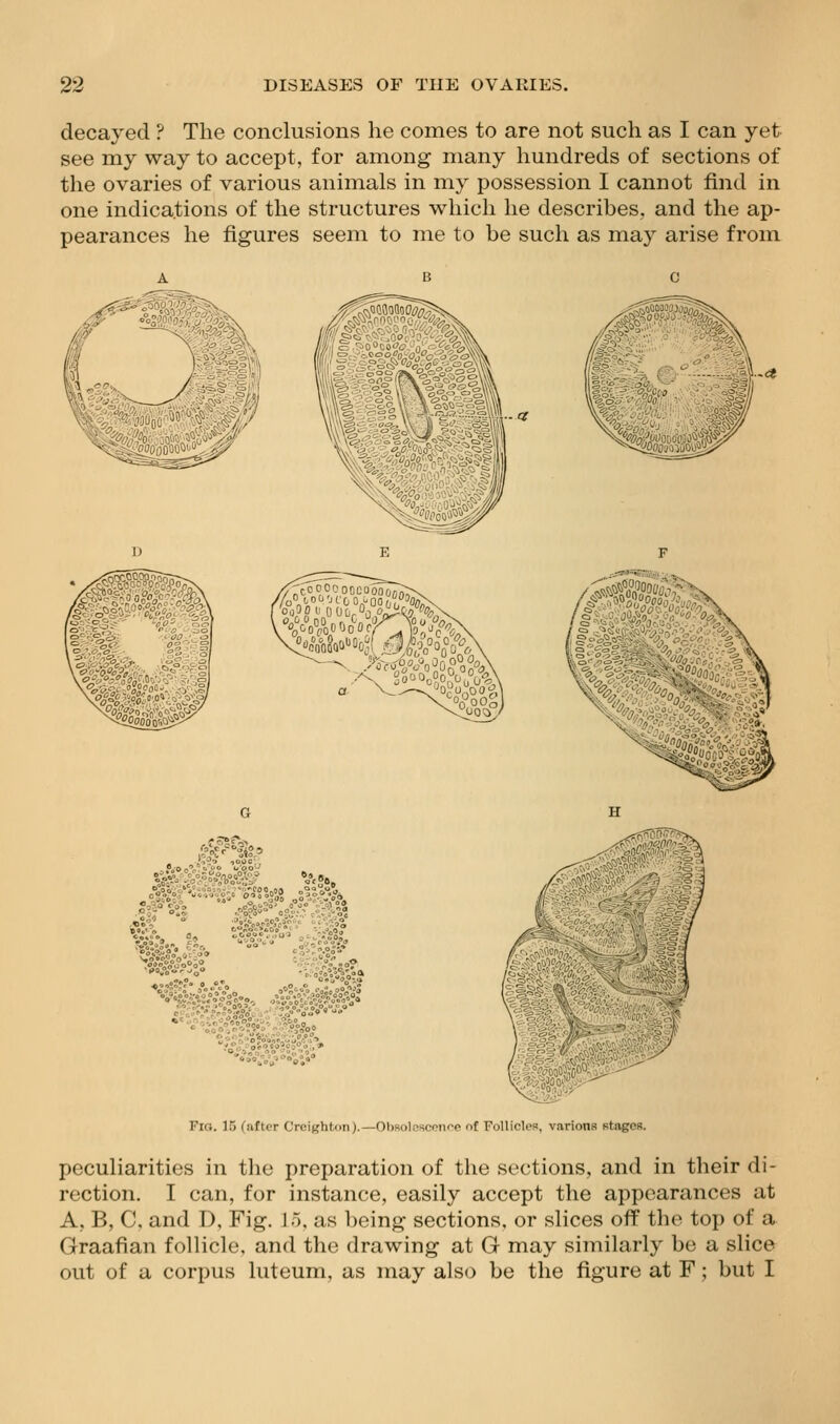 decayed ? The conclusions he comes to are not such as I can yet see my way to accept, for among many hundreds of sections of the ovaries of various animals in my possession I cannot find in one indications of the structures which he describes, and the ap- pearances he figures seem to me to be such as may arise from a ■<>0°%''o°S°O Fio. 15 ('after Creif,'ht,(>n).—OIjsoI.-'scoiipo ni FollicU-s, vsirions stages. peculiarities in the preparation of the sections, and in their di- rection. I can, for instance, easily accept the appearances at A, B, C. and D, Fig. 15, as being sections, or slices off the top of a Graafian follicle, and the drawing at G may similarly be a slice out of a corpus luteum, as may also be the figure at F; but I