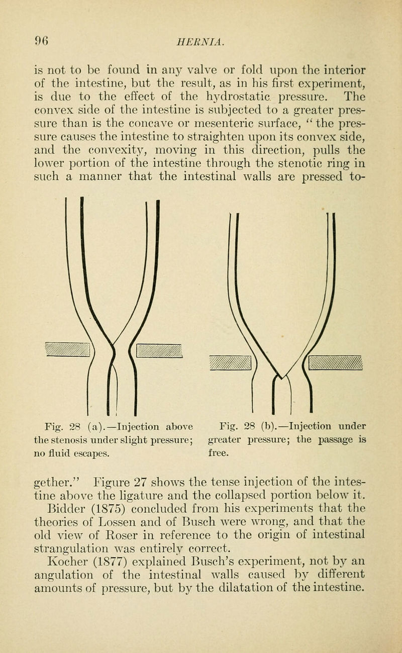 is not to be found in any valve or fold upon the interior of the intestine, but the result, as in his first experiment, is due to the effect of the h3^drostatic. pressure. The convex side of the intestine is subjected to a greater pres- sure than is the concave or mesenteric surface, '' the pres- sure causes the intestine to straighten upon its convex side, and the convexit}^, moving in this direction, pulls the lower portion of the intestine through the stenotic ring in such a manner that the intestinal walls are pressed to- Fig. 28 (a).—Injection above Fig. 28 (b).—Injection under the stenosis under slight pressure; greater pressure; the passage is no fluid escapes. free. gether. Figure 27 shows the tense injection of the intes- tine above the ligature and the collapsed portion below it. Bidder (1875) concluded from his experiments that the theories of Lossen and of Busch were wrong, and that the old view of Roser in reference to the origin of intestinal strangulation was entirely correct. Kocher (1877) explained Busch's experiment, not by an angulation of the intestinal walls caused by different amounts of pressure, but by the dilatation of the intestine.