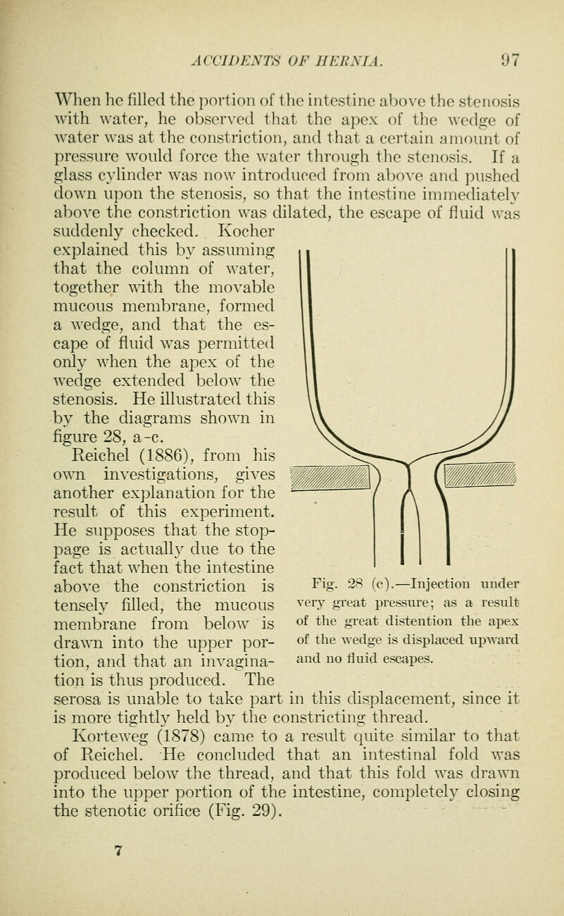 When he filled the portion of the intestine above the stenosis with water, he observed that the apex of the wedge of water was at the constriction, and that a certain amount of pressure would force the water through the stenosis. If a glass cylinder was now introduced from above and pushed down upon the stenosis, so that the intestine immediately above the constriction was dilated, the escape of fluid was suddenly checked. Kocher explained this by assuming that the column of water, together with the movable mucous membrane, formed a wedge, and that the es- cape of fluid was permitted only when the apex of the wedge extended below the stenosis. He illustrated this by the diagrams shown in figure 28, a-c. Reichel (1886), from his own investigations, gives another explanation for the result of this experiment. He supposes that the stop- page is actually due to the fact that when the intestine above the constriction is tensely filled, the mucous membrane from below is drawn into the upper por- tion, and that an invagina- tion is thus produced. The serosa is unable to take part in this displacement, since it is more tightly held by the constricting thread. Korteweg (1878) came to a result quite similar to that of Reichel. He concluded that an intestinal fold was produced below the thread, and that this fold was drawn into the upper portion of the intestine, completely closing the stenotic orifice (Fig. 29).  Fig. 28 (c).—Injection under very great pressure; as a result of the great distention the apex of the wedge is displaced upward and no fluid escapes.