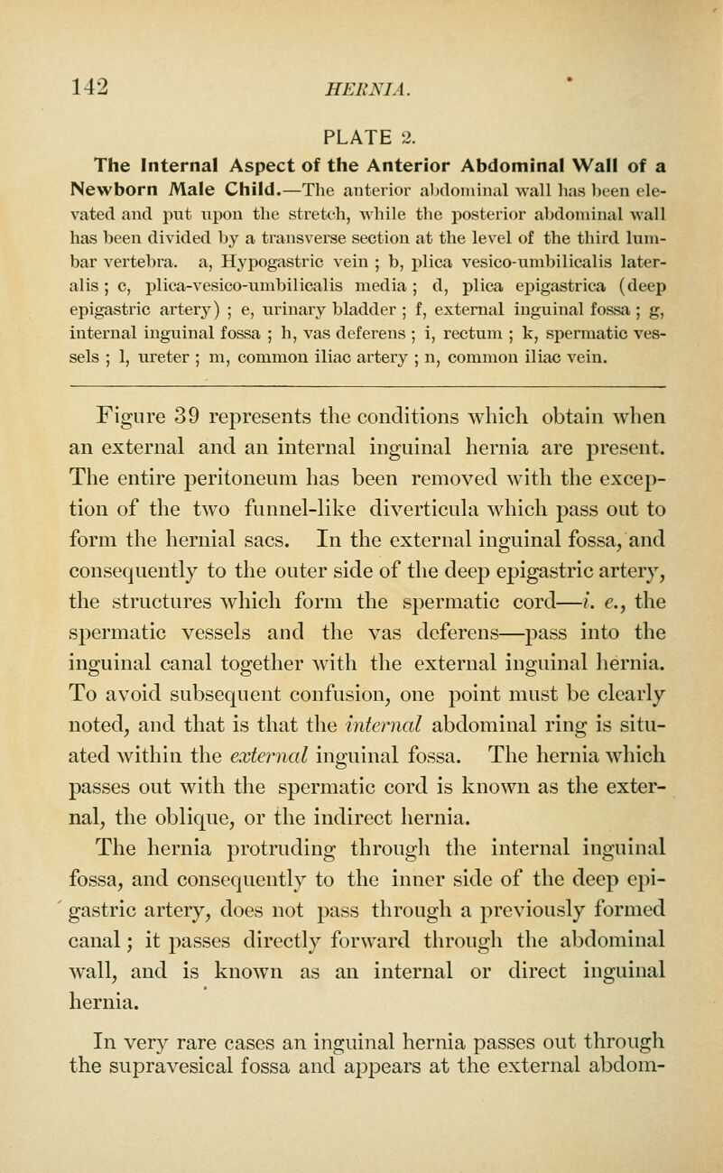 PLATE 2. The Internal Aspect of the Anterior Abdominal Wall of a Newborn Male Child.—The anterior abdominal wall has been ele- vated and put upon the stretch, while the posterior abdominal wall has been divided by a transverse section at the level of the third lum- bar vertebra, a, Hypogastric vein ; b, plica vesico-umbilicalis later- alis ; c, plica-vesico-umbilicalis media; d, plica epigastrica (deep epigastric artery) ; e, urinary bladder ; f, external inguinal fossa ; g, internal inguinal fossa ; h, vas deferens ; i, rectum ; k, spermatic ves- sels ; 1, ureter ; m, common iliac artery ; n, common iliac vein. Figure 39 represents the conditions which obtain when an external and an internal inguinal hernia are present. The entire peritoneum has been removed with the excep- tion of the two funnel-like diverticula which pass out to form the hernial sacs. In the external inguinal fossa/and consequently to the outer side of the deep epigastric artery, the structures which form the spermatic cord—i. e., the spermatic vessels and the vas deferens—pass into the inguinal canal together with the external inguinal hernia. To avoid subsequent confusion, one point must be clearly noted, and that is that the internal abdominal ring is situ- ated within the external inguinal fossa. The hernia which passes out with the spermatic cord is known as the exter- nal, the oblique, or the indirect hernia. The hernia protruding through the internal inguinal fossa, and consequently to the inner side of the deep epi- gastric artery, does not pass through a previously formed canal; it passes directly forward through the abdominal wall, and is known as an internal or direct inguinal hernia. In very rare cases an inguinal hernia passes out through the supravesical fossa and appears at the external abdom-