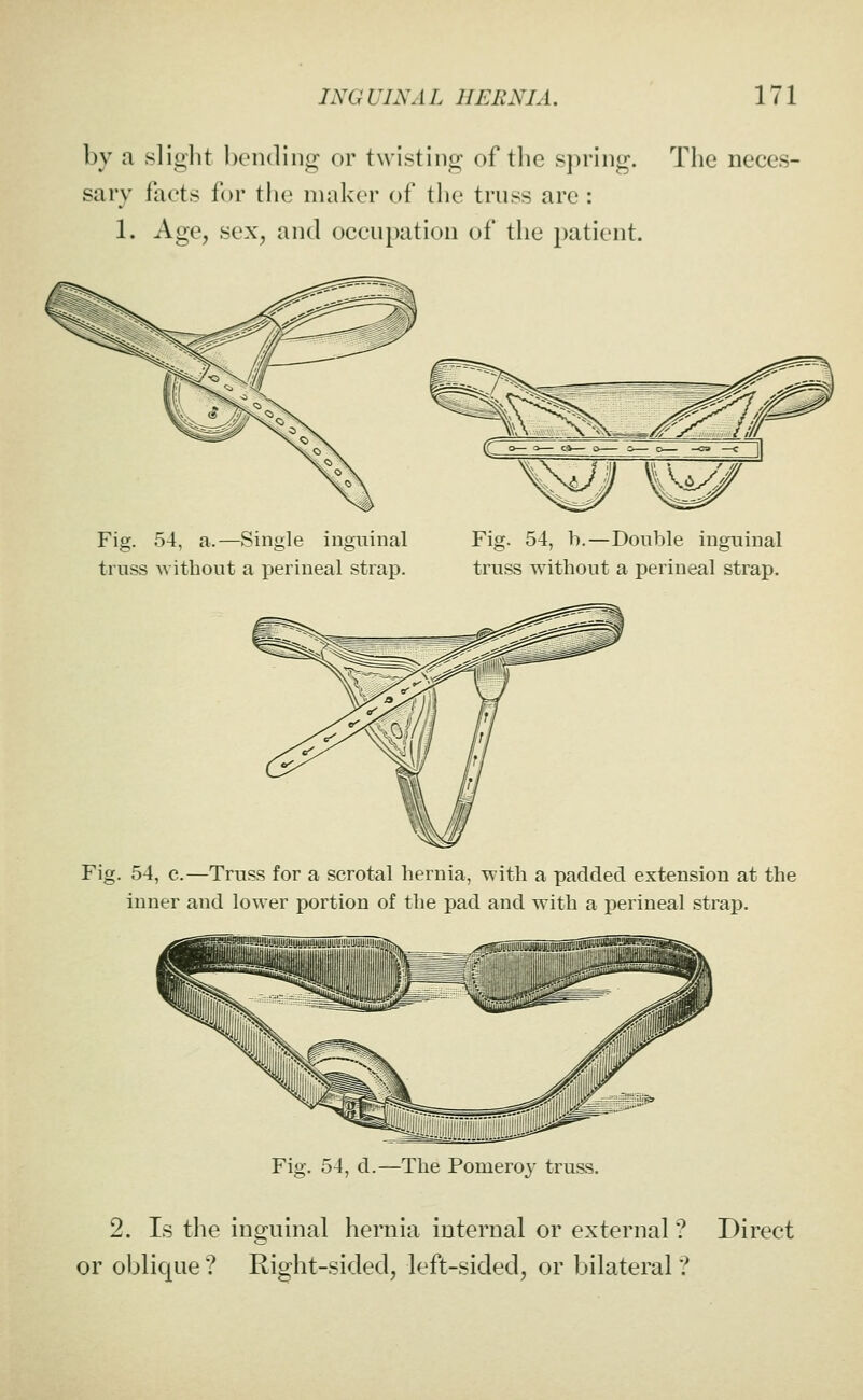 by a slight honding or twisting of the s])ring. Tlie neces- sary facts for the maker of the truss are : 1. Age, sex, and occupation of the patient. Fig. 54, a.—Single inguinal truss Avithout a j)erineal strap. Fig. 54, b.—Double inguinal truss without a perineal strap. Fig. 54, c.—Truss for a scrotal hernia, with a padded extension at the inner and lower portion of the pad and with a perineal strap. Fig. 54, d.—The Pomeroy truss. 2. Is the inguinal hernia internal or external? Direct or oblique ? Right-sided, left-sided, or bilateral ?