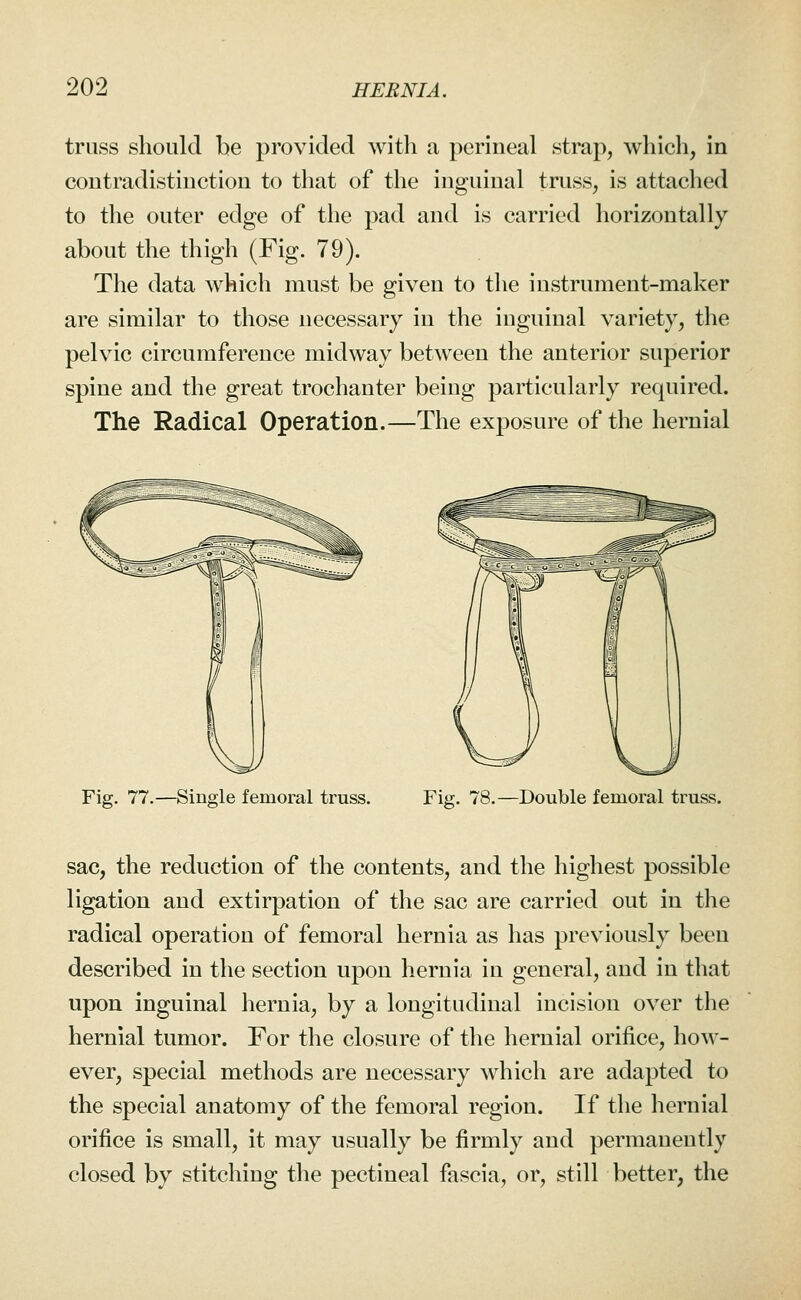 truss should be provided with a perineal strap, which, in contradistinction to that of the inguinal truss, is attached to the outer edge of the pad and is carried horizontally about the thigh (Fig. 79). The data which must be given to the instrument-maker are similar to those necessary in the inguinal variety, the pelvic circumference midway between the anterior superior spine and the great trochanter being particularly required. The Radical Operation.—The exposure of the hernial Fig. 77.—Single femoral truss. Fig. 78.—Double femoral truss. sac, the reduction of the contents, and the highest possible ligation and extirpation of the sac are carried out in the radical operation of femoral hernia as has previously been described in the section upon hernia in general, and in that upon inguinal hernia, by a longitudinal incision over the hernial tumor. For the closure of the hernial orifice, how- ever, special methods are necessary which are adapted to the special anatomy of the femoral region. If the hernial orifice is small, it may usually be firmly and permanently closed by stitching the pectineal fascia, or, still better, the