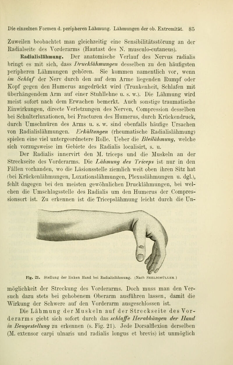 Zuweilen beobachtet man gleichzeitig eine Sensibilitätsstörung an der Radialseite des Vorderarms (Hautast des N. musculo-cutaneus). Radialislähmung-. Der anatomische Verlauf des Nervus radialis bringt es mit sich, dass Drucklähmungen desselben zu den häufigsten peripheren Lähmungen gehören. Sie kommen namentlich vor, wenn im Schlaf der Nerv durch den auf dem Arme liegenden Eumpf oder Kopf gegen den Humerus angedrückt wird (Trunkenheit, Schlafen mit überhängendem Arm auf einer Stuhllehne u. s. w.). Die Lähmung wird meist sofort nach dem Erwachen bemerkt. Auch sonstige traumatische Einwirkungen, directe Verletzungen des Nerven, Compression desselben bei Schulterluxationen, bei Fracturen des Humerus, durch Krückendruck, durch Umschnüren des Arms u. s. w. sind ebenfalls häufige Ursachen von Eadiahslähmungen. Erkältungen (rheumatische Eadialislähmung) spielen eine viel untergeordnetere Rolle. Ueber die Bleilähmung, welche sich vorzugsweise im Gebiete des Radialis localisirt, s. u. Der Radialis innervirt den M. triceps und die Muskeln an der Streckseite des Vorderarms. Die Lähmung des Tfnceps ist nur in den Fällen vorhanden, wo die Läsionsstelle ziemlich weit oben ihren Sitz hat (bei Krückenlähmungen, Luxationslähmungen, Plexuslähmungen u. dgl.), fehlt dagegen bei den meisten gewöhnlichen Drucklähmungen, bei wel- chen die Umschlagsstelle des Radiahs um den Humerus der Compres- sionsort ist. Zu erkennen ist die Tricepslähmung leicht durch die Un- Fig. 21. Stellung der linken Hand bei Eadialislähmung. (Nach Seeligmüller.) möghchkeit der Streckung des Vorderarms. Doch muss man den Ver- such dazu stets bei gehobenem Oberarm ausführen lassen, damit die Wirkung der Schwere auf den Vorderarm ausgeschlossen ist. Die Lähmung der Muskeln auf der Streckseite des Vor- derarms giebt sich sofort durch (\?i^ schlaffe Herabhängen der Hand in Beugestellung zu erkennen (s. Fig. 21). Jede Dorsalflexion derselben (M. extensor carpi ulnaris und radialis longus et brevis) ist unmöglich