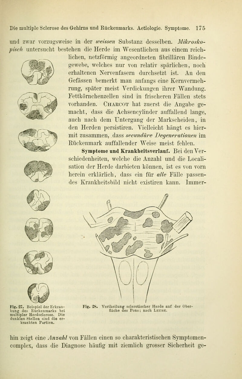 und zwar vorzugsweise in der weissen Substanz desselben. Mikrosko- p/'sc/i untersucht bestehen die Herde im Wesentlichen aus einem reich- lichen, netzförmig angeordneten fibrillären Binde- gewebe, welches nur von relativ spärlichen, noch erhaltenen Nervenfasern durchsetzt ist. An den Gefässen bemerkt man anfangs eine Kernvermeh- rung, später meist Verdickungen ihrer Wandung. Fettkömchenzellen sind in frischeren Fällen stets vorhanden. Chaecot hat zuerst die Angabe ge- macht, dass die Achsencjlinder auffallend lange, auch nach dem Untergang der Markscheiden, in den Herden persistiren. Vielleicht hängt es hier- mit zusammen, dass secundm^e Degenerationen im Kückenmark auffallender Weise meist fehlen. Symptome und Krankheitsverlauf. Bei den Ver- schiedenheiten, welche die Anzahl und die Locali- sation der Herde darbieten können, ist es von vom herein erklärlich, dass ein für alle Fälle passen- des Krankheitsbild nicht existiren kann. Immer- Fig. 27. Beispiel der Erkran- kung des Rückenmarks bei multipler Herdsclerose. Die dunklen Stellen sind die er- krankten Partien. Fig. 2S. Vertlieilung sclerotisclier Herde auf der Ober- fläche des Pons; nach Leuhe. hin zeigt eine Anzahl von Fällen einen so charakteristischen S^onptomen- complex, dass die Diagnose häufig mit ziemhch grosser Sicherheit ge-