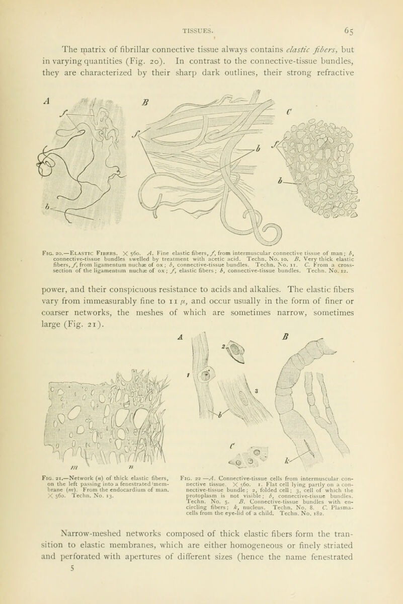 The matrix of fibrillar connective tissue always contains elastic fibers, but in varying quantities (Fig. 20). In contrast to the connective-tissue bundles, they are characterized by their shar]) dark outlines, their strong refractive '^^'Q^^ Fig. 20.—Elastic Fibfrs. X 560- A. Fine elastic fibe connective-tissue bundles swelled by treatment wit fibers, y, from ligamentum nuchae of ox ; b, connective- section of the ligamentum nucha; of ox ; /, clastic fibe , y, from intermuscul issue of man; *, _jhn. No. 10. B. Very thick elastic issue bundles. Techn. No. 11. C From a cross- s; b, connective-tissue bimdles. Techn. No. 12. power, and their cons])icuous resistance to acids and alkalies. The elastic fibers vary from immeasurably fine to ii i>., and occur usually in the form of finer or coarser networks, the meshes of which are sometimes narrow, sometimes large (Fig. 21). Fig. 21.—Network («) of thick elastic fibers, on the left p:issing into a fenestrated'mem- brane (w/). From the endocardium of man. X 560. Techn. No. 13. '' -^K «i© 9 ; ^ h Fig. 22 —A. Connective>tissue cells from intermuscular ncctive tissue. X s6o. i. Flat cell lying partly on a nective-tissue bundle : 2, folded cell: 3. cell of whicl protoplasin is not_visible; b, connective-tissue bundles. Techn. No. 5. B, Coimective-tissue bundle: circling fibers: *, nucleus. Techn. No. 8. C. PI cells from the eye-lid of a child. Techn. No. 182 th Narrow-meshed networks composed of thick elastic fibers form the tran- sition to elastic membranes, which are either homogeneous or finely .striated and perforated with apertures of different sizes (hence the name fenestrated 5