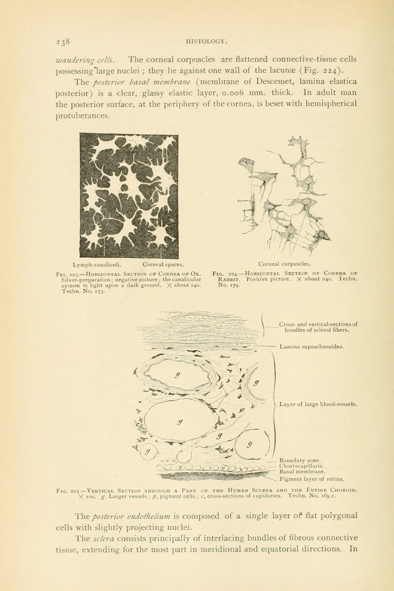 7vanileriiig cells. The corneal corpuscles are flattened connective-tissue cells possessingHarge nuclei ; they lie against one wall of the lacunae (Fig. 224). The posterior basal membrane (membrane of Descemet, lamina elastica posterior) is a clear, glassy elastic layer, 0.006 mm. thick. In adult man the posterior surface, at the periphery of the cornea, is beset with hemispherical protuberances. Lymph-canalicul :al spaces Fig. 223.—Horizontal Section of Cornea of Ox. Silver-preparation; negative picture ; the canalicular system is light upon a dark ground. X about 240. Techn. No. 173. Corneal corpuscles. Fig. 224.—Horizontal Section of Cornea op Rabbit. Positive picture. X about 240. lechn. No. 174. The.posterior endothelium is composed of a single la)-er of flat j)olygonal cells with slightly projecting nuclei. The sclera consists principally of interlacing bundles of fibrous connective tissue, extending for the most part in meridional and equatorial directions. In