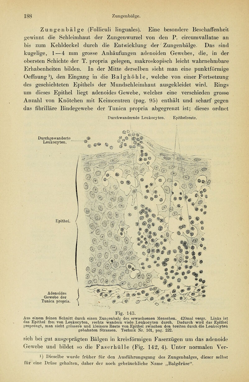 Zungen bälge (Folliculi linguales). Eine besondere Beschaffenheit gewinnt die Schleimhaut der Zungenwurzel von den P. circumvallatae an bis zum Kehldeckel durch die Entwicklung der Zungenbälge. Das sind kugelige, 1—4 mm grosse Anhäufungen adenoiden Gewebes, die, in der obersten Schichte der T. propria gelegen, makroskopisch leicht wahrnehmbare Erhabenheiten bilden. In der Mitte derselben sieht man eine punktförmige Oeffnung'), den Eingang in die Balghöhle, welche von einer Fortsetzung des geschichteten Epithels der Mundschleimhaut ausgekleidet wird. Rings um dieses Epithel liegt adenoides Gewebe, welches eine verschieden grosse Anzahl von Knötchen mit Keimcentren (pag. 95) enthält und scharf gegen das fibrilläre Bindegewebe der Tunica propria abgegrenzt ist; dieses ordnet Durchwandernde Leukocyten. Epithelreste. Durchgewanderte Leukocyten. Epithel. Adenoides Gewebe der Tunica propria. Fig. 143. Aus einem feinen Schnitt durch einen Zungenbalg des erwachsenen Menschen. 420mal vergr. Links ist das Epithel frei von Leukocjrten, rechts wandern viele Leukocyten durch. Dadurch wird das Epithel gesprengt, man sieht grössere und kleinere Eeste von Epithel zwischen den breiten durch die Leukocyten gebahnten Strassen. Technik Nr. 101, pag. 222. sich bei gut ausgeprägten Bälgen in kreisförmigen Faserzügen um das adenoide Gewebe und bildet so die Faserhülle (Fig. 142, 4). Unter normalen Ver- 1) Dieselbe wurde früher für den Ausführungsgang des Zungenbalges, dieser selbst für eine Drüse gehalten, daher der noch gebräuchliche Name „Balgdrüse.