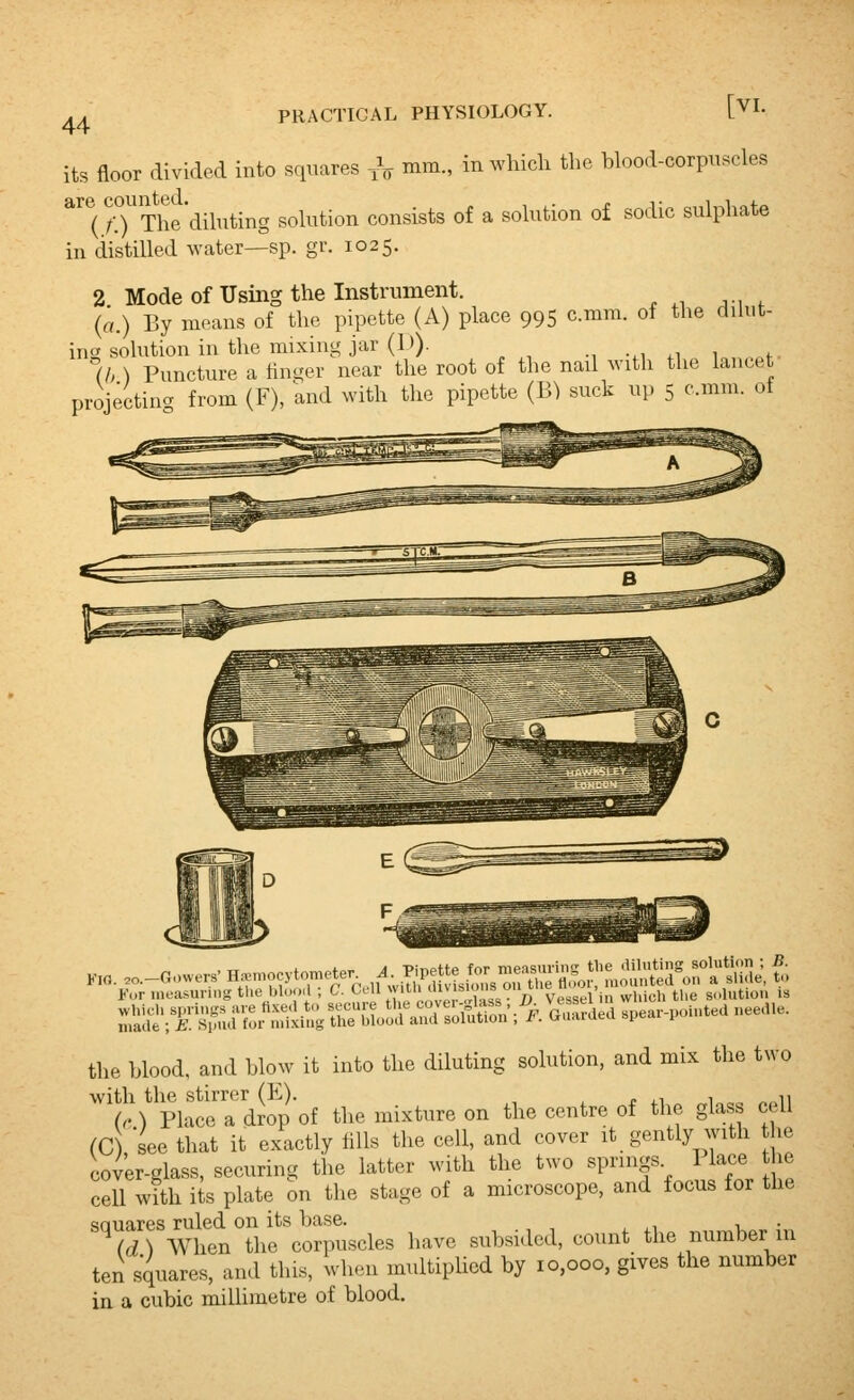 its floor divided into squares -,V mm., in which the blood-corpuscles ^(rrThe'dihiting solution consists of a solution of sodic sulphate in distilled water—sp. gr. 1025. 2 Mode of Using the Instrument. (a.) By moans of the pipette (A) place 995 cmm. of the dilut- ing solution in the mixing jar (D). u. ^f (b ) Puncture a finger near the root of the nail with the lancet projecting from (F), and with the pipette (B^ suck up 5 cmm. of 1 t„- A -Piripffp fnr mpasuriii'' tlie diluting solutiim ; B. ^-/:^!;=;S^^ffit'c4K^r^5>e ^. a suae, .. the Wood, and blow it into the diluting sohition, and mix the two with the stirrer (E). , ■,, (. ) Place a drop of the mixture on the centre of the glass cell (C , see that it exactly fills the cell, and cover it gently with he cover-glass, securing the latter with the two springs 1 lace he cell with its plate on the stage of a microscope, and focus for the so uares ruled on its base. . (d) AVhen the corpuscles have subsided, count the number in ten squares, and this, when multiplied by 10,000, gives the number in a cubic millimetre of blood.