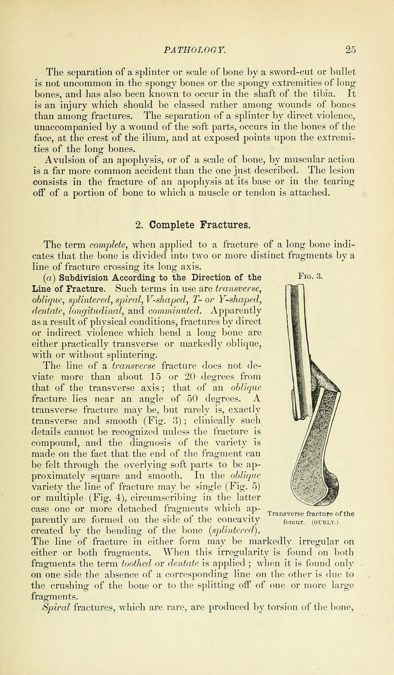 The separation of a splinter or scale of bone by a sword-cut or bullet is not uncommon in the spongy bones or the spongy extremities of long bones, and has also been known to occur in the shaft of the tibia. It is an injury which should be classed rather among wounds of bones than among fractures. The separation of a splinter by direct violence, unaccompanied by a wound of the soft parts, occurs in the bones of the face, at the crest of the ilium, and at exposed points upon the extremi- ties of the long bones. Avulsion of an apophysis, or of a scale of bone, by muscular action is a far more common accident than the one just described. The lesion consists in the fracture of an apophysis at its base or in the tearing off of a portion of bone to which a muscle or tendon is attached. Fig. 3. 2. Complete Fractures. The term complete, when applied to a fracture of a long bone indi- cates that the bone is divided into two or more distinct fragments by a line of fracture crossing its long axis. (a) Subdivision According to the Direction of the Line of Fracture. Such terms in use are transverse^ oblique, splintered, spiral, V-shaped, T- or Y-shaped, dentate, longitudinal, and comminuted. Apparently as a result of physical conditions, fractures by direct or indirect violence which bend a long bone are either practically transverse or markedly oblique, with or without splintering. The line of a transverse fracture does not de- viate more than about 15 or 20 degrees from that of the transverse axis; that of an oblique fracture lies near an ano;le of 50 degrees. A transverse fracture may be, but rarely is, exactly transverse and smooth (Fig. 3); clinically such details cannot be recognized uuless the fracture is compound, and the diagnosis of the variety is made on the fact that the end of the fragment can be felt through the overlying soft parts to be ap- proximately square and smooth. In the oblique variety the line of fracture may be single (Fig. 5) or multiple (Fig. 4), circumscribing in the latter case one or more detached fragments which ap- parently are formed on the side of the concavity created by the bending of the bone (splintered). The line of fracture in either form may be markedly irregular on either or both fragments. AYhen this irregularity is found on both fragments the term toothed or dentate is applied ; when it is found only on one side the absence of a corresponding line on the other is due to the crushing of the bone or to tlie splitting off of one or more large fragments. Spiral fractures, which are rare, are produced by torsion of the bone, Transverse fracture of the femur, (gurlt.)