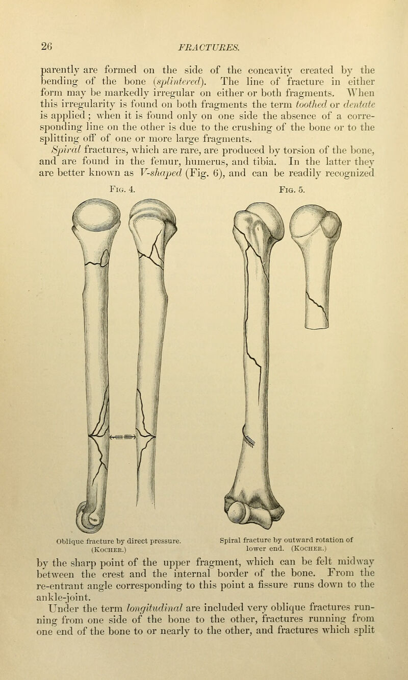 parently are formed on the side of the concavity created l^y the bending of the bone [splintered). The line of fracture in either form may be markedly irregular on either or both frag-ments. When this irregularity is found on l)oth fragments the term toothed or derdcde is applied; \vhen it is found only on one side the absence of a corre- sponding line on the other is due to the crushing of the bone or to the splitting off' of one or more large fragments. Sjjircd fractures, which are rare, are produced l^y torsion of the Ijone, and are found in the femur, humerus, and tibia. In the latter they are better known as V-shaped (Fig. 6), and can be readily recognized Fig. 4. Fig. 5. Oblique fracture by direct pressure. Spiral fracture by outward rotation of (KocHEE.) lower end. (Kocher.j by the sharp point of the upper fragment, which can be felt midway between the crest and the internal border of the bone. From the re-entrant angle corresponding to this point a fissure runs down to the ankle-joint. Under the term longitudinal are included very ol^lique fractures run- ning from one side of the bone to the other, fractures running from one end of the bone to or nearly to the other, and fractures which split