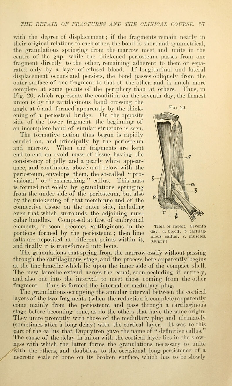 Fig. 20. with the degree of (Hsplacoment ; if the fragments remain nearly in their original relations to each other, the bond is short and symmetrical, the grannlations springing from the marrow meet and unite in the centre of the gap, while the thickened periosteum passes from one fragment directly to the other, remaining adherent to them or sepa- rated only by a layer of effused blood. If longitudinal and lateral displacement occurs and persists, the bond passes obliquely from the outer surface of one fragment to that of the other, and is much more complete at some points of the periphery than at others. Thus, in Fig. 20, which represents the condition on the seventh day, the firmest union is by the cartilaginous band crossing the angle at b and formed apparently by the thick- ening of a periosteal bridge. On the opposite side of the lower fragment the beginning of an incomplete band of similar structure is seen. The formative action thus begun is rapidly carried on, and principally by the periosteum and marrow. When the fragments are kept end to end an ovoid mass of tissue, having the consistency of jelly and a pearly white appear- ance, and continuous above and below with the periosteum, envelops them, the so-called  pro- visional  or  ensheathing  callus. This mass is formed not solely by granulations springing from the under side of the periosteum, but also by the thickening of that membrane and of the connective tissue on the outer side, including even that which surrounds the adjoining mus- cular bundles. Composed at first of embryonal elements, it soon becomes cartilaginous in the portions formed by the periosteum ; then lime salts are deposited at different points within it, and finally it is transformed into bone. The granulations that spring from the marrow ossify without passing through the cartilaginous stage, and the process here apparently begins at the fine lamellae which lie upon the inner side of the compact shell. The new lamellae extend across the canal, soon occluding it entirely, and also out into the interval to meet those comin: from the other fragment. Thus is formed the internal or medullary plug. The granulations occupying the annular interval between the cortical layers of the two fragments (when the reduction is complete) apparently come mainly from the periosteum and pass through a cartilaginous stage before becoming bone, as do the others that have the same origin. They unite promptly with those of the medullary plug and ultimately (sometimes after a long delay) with the cortical layer. It was to this part of the callus that Dupuytren gave the name of  definitive callus. The cause of the delay in union with the cortical layer lies in the slow- 'S with which the latter forms the granulations necessary to unite /i^ith the others, and doubtless to the occasional long persistence of a necrotic scale of bone on its broken surface, which has to be slowly Tibia of rabbit. Seventh day: a, blood; 6, cartilag- inous callus; c, muscles. (GUELT.)