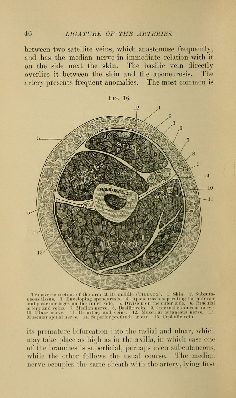 between two satellite veins, which anastomose frequently, and has the median nerve in immediate relation with it on the side next the skin. The basilic vein directly overlies it between the skin and the aponeurosis. The artery presents frequent anomalies. The most common is Fig. 16. Transverse section of the arm at its middle (Tillaux). i. Skin. 'J. Subcuta- neous tissue. '■'•■ Enveloping aponeurosis, i. Aponeurosis separating the anterior and posterior loges on trie inner side. 5. Division on the outer side. 6. Brachial artery and veins. 7. Median nerve. 8. Basilic vein. 9. Internal cutaneous nerve. 10. ulnar nerve. II. Its artery and veins. 12, Muscular cutaneous nerve, i::. Muscular spinal nerve. 14. Superior profunda artery. i>. Cephalic vein. it> premature bifurcation into the radial and ulnar, which may take place as high as in the axilla, in which case one of the branches is superficial, perhaps even subcutaneous, while the other follows the usual course. The median nerve occupies the same sheath with the artery, lying first