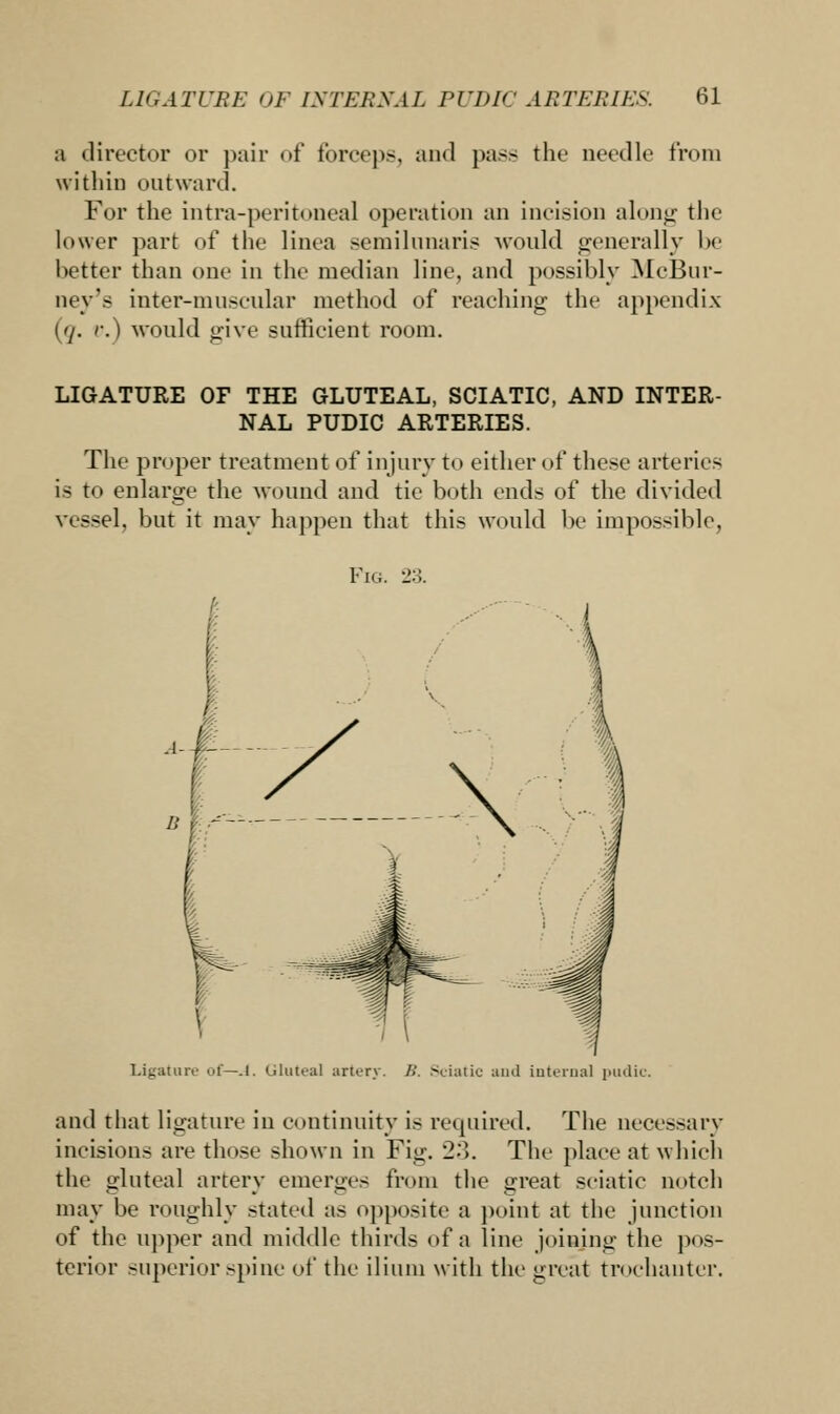 a director or pair of forceps, and pass the needle from within outward. For the intra-peritoneal operation an incision along the lower part of the linea semilunaris would generally be better than one in the median line, and possibly McBnr- ney's inter-muscular method of reaching the appendix (7. r.) would give sufficient room. LIGATURE OF THE GLUTEAL, SCIATIC, AND INTER- NAL PUDIC ARTERIES. The proper treatment of injury to either of these arteries is to enlarge the wound and tie both ends of the divided vessel, but it may happen that this would be impossible, Fig. 23. Ligature of—J. Gluteal artery. />'. Sciatic and internal pudic. and that ligature in continuity is required. The necessary incisions are those shown in Fig. 2-*>. The place at which the gluteal artery emerges from the great sciatic notch may be roughly stated as opposite a point at the junction of the upper and middle thirds of a line joining the pos- terior superior spine of the ilium with the great trochanter.