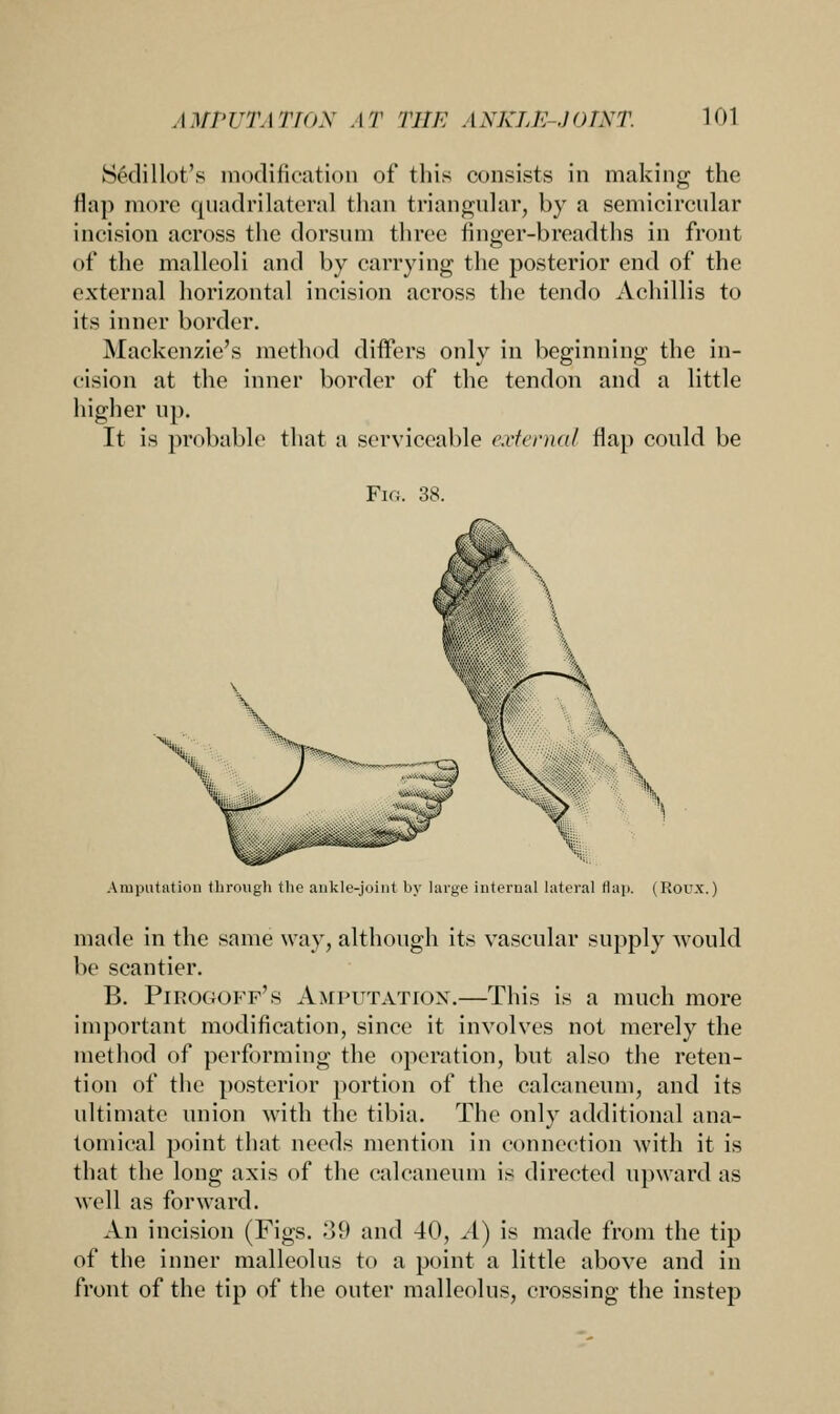 Sedillot's modification of this consists in making the flap more quadrilateral than triangular, by a semicircular incision across the dorsum three finger-breadths in front of the malleoli and by carrying the posterior end of the external horizontal incision across the tendo Achillis to its inner border. Mackenzie's method differs only in beginning the in- cision at the inner border of the tendon and a little higher up. It is probable that a serviceable external flap could be Fig. 38. Amputation through the ankle-joint by large internal lateral Hap. (Roux.) made in the same way, although its vascular supply would be scantier. B. Pirogoff's Amputation.—This is a much more important modification, since it involves not merely the method of performing the operation, but also the reten- tion of the posterior portion of the calcanenm, and its ultimate union with the tibia. The only additional ana- tomical point that needs mention in connection with it is that the long axis of the calcanenm is directed upward as well as forward. An incision (Figs. 39 and 40, A) is made from the tip of the inner malleolus to a point a little above and in front of the tip of the onter malleolus, crossing the instep