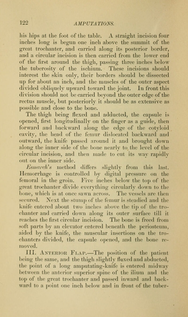 his hips at the foot of the table. A straight incision four inches long is begun one inch above the summit of the great trochanter, and carried along its posterior border, and a circular incision is then carried from the lower end of the first around the thigh, passing three inches below the tuberosity of the ischium. These incisions should interest the skin only, their borders should be dissected up for about an inch, and the muscles of the outer aspect divided obliquely upward toward the joint. In front this division should not be carried beyond the outer edge of the rectus muscle, but posteriorly it should be as extensive as possible and close to the bone. The thigh being flexed and adducted, the capsule is opened, first longitudinally on the finger as a guide, then forward and backward along the edge of the cotyloid cavity, the head of the femur dislocated backward and outward, the knife passed around it and brought down along the inner side of the bone nearly to the level of the circular incision, and then made to cut its way rapidly out on the inner side. Esmarch's method differs slightly from this last. Hemorrhage is controlled by digital pressure on the femoral in the groin. Five inches below the top of the great trochanter divide everything circularly down to the bone, which is at once sawn aero-.-. The vessels are then secured. Next the stump of the femur is steadied and the knife entered about two inches above the tip of the tro- chanter and carried down along its outer surface till it reaches the first circular incision. The bone i- \'v<hh\ from -oft parts by an elevator entered beneath the periosteum, aided by the knife, the muscular insertions on the tro- chanters divided, the capsule opened, and the bone re- moved. III. A.NTERIOB FLAP.—The position of the patient being the same, and the thigh slightly flexed and abducted, the point of a long amputating-knife is entered midway between the anterior superior -pine of the ilium and the top of the greai trochanter and passed inward and hack- ward to ;i point one inch below and in front of the tuber-