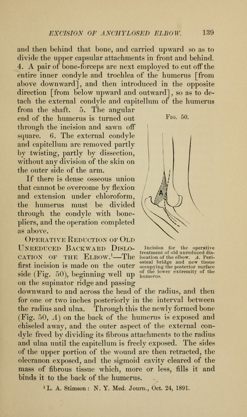 Fig. 50. and then behind that bone, and carried upward so as to divide the upper capsular attachments in front and behind. 4. A pair of bone-forceps are next employed to cut off the entire inner condyle and trochlea of the humerus [from above downward], and then introduced in the opposite direction [from below upward and outward], so as to de- tach the external condyle and capitellum of the humerus from the shaft. 5. The angular end of the humerus is turned out through the incision and sawn off' square, 6. The external condyle and capitellum are removed partly by twisting, partly by dissection, without any division of the skin on the outer side of the arm. If there is dense osseous union that cannot be overcome by flexion and extension under chloroform, the humerus must be divided through the condyle with bone- pliers, and the operation completed as above. Operative Reduction of Old Unreduced Backward Dislo- cation of the Elbow.1—The first incision is made on the outer side (Fig. 50), beginning well up (in the supinator ridge and passing downward to and across the head of the radius, and then for one or two inches posteriorly in the interval between the radius and ulna. Through this the newly formed bone (Fig. 50, A) on the back of the humerus is exposed and chiseled away, and the outer aspect of the external con- dyle freed by dividing its fibrous attachments to the radius and ulna until the capitellum is freely exposed. The sides of the upper portion of the wound are then retracted, the olecranon exposed, and the sigmoid cavity cleared of the mass of fibrous tissue which, more or less, fills it and binds it to the back of the humerus. »L. A. Stimson: N. Y. Med. Journ., Oct. 24, 1891. Incision for the operative treatment of old unreduced dis- location of the elbow. A. Peri- osteal bridge and new tissue occupying the posterior surface of the lower extremity of the humerus.
