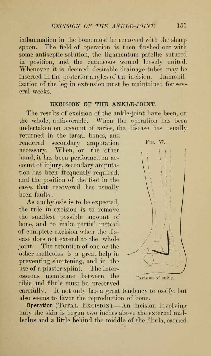 Fig. inflammation in the bone must be removed with the sharp spoon. The field of operation is then flushed out with some antiseptic solution, the ligamentum patellae sutured in position, and the cutaneous wound loosely united. Whenever it is deemed desirable drainage-tubes may be inserted in the posterior angles of the incision. Immobil- ization of the leg in extension must bo maintained for sev- eral weeks. EXCISION OF THE ANKLE-JOINT. The results of excision of the ankle-joint have been, on the whole, unfavorable. When the operation has been undertaken on account of caries, the disease has usually returned in the tarsal bones, and rendered secondary amputation necessary. When, on the other hand, it has been performed on ac- count of injury, secondary amputa- tion has been frequently required, and the position of the foot in the cases that recovered has usually been faulty. As anchylosis is to be expected, the rule in excision is to remove the smallest possible amount of bone, and to make partial instead of complete excision when the dis- ease does not extend to the whole joint. The retention of one or the other malleolus is a great help in preventing shortening, and in the use of a plaster splint. The inter- osseous membrane between the tibia and fibula must be preserved carefully. It not only has a great tendency to ossify, but also seems to favor the reproduction of bone. Operation (Total Excision).—An incision involving only the skin is begun two inches above the external mal- leolus and a little behind the middle of the fibula, carried Excision of ankle.