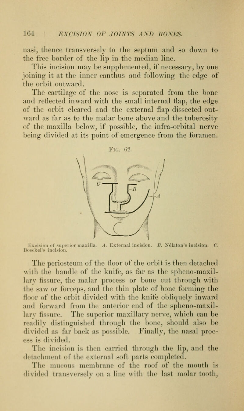 nasi, thence transversely to the septum and so down to the free border of the lip in the median line. This Incision may be supplemented, if accessary, by one joining it at the inner canthus and following- the edge of th 'bit outward. The cartilage of the nose is separated from the bone and reflected inward with the small internal flap, the edge of the orbit cleared and the external flap dissected out- ward as far as to the malar bone above and the tuberosity of the maxilla below, if possible, the infra-orbital nerve being divided at its point of emergence from the foramen. Fi.i. 62. Excision of Buperior maxilla. .1. Externa] incision. B. Nfilaton's incision, c. Boeckel's incision. The periosteum of the floor of the orbit is then detached with the handle of the knife, as far as the spheno-maxil- larv fissure, the malar process or bone cut through with iIm- -aw or forceps, and the thin plate of bone forming the floor of the orbit divided with the knife obliquely inward and forward from the anterior end of the sphenomaxil- lary fissure. The superior maxillary nerve, which can !><■ readily distinguished through the bone, should also be divided as far back as possible, finally, the nasal proc- ess is divided. The incision i- then carried through the lip, and the detachmeni of the externa] -oft parts completed. The mucous membrane of the roof of the mouth is divide.I transversely on a line with the last molar tooth.