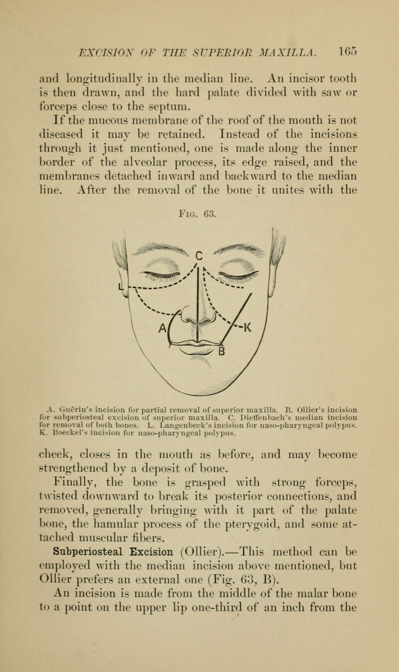 and longitudinally in the median line. An incisor tooth is then drawn, and the hard palate divided with saw or forceps close to the septum. If the mucous membrane of the roof of the mouth is not diseased it may be retained. Instead of the incisions through it just mentioned, one is made along the inner border of the alveolar process, its edge raised, and the membranes detached inward and backward to the median line. After the removal of the bone it unites with the Fig. 63. A. Guerin's incision for partial removal of superior maxilla. B. Oilier's incision for subperiosteal excision of superior maxilla. C. Dieffenbach's median incision for removal of both bones. L. Langenbeck's incision for naso-pbaryngeal polypus. K. Boeckel's incision for uaso-pharyngeaJ polypus. cheek, closes in the mouth as before, and may become strengthened by a deposit of bone. Finally, the bone is grasped with strong forceps, twisted downward to break its posterior connections, and removed, generally bringing with it part of the palate bone, the hamular process of the pterygoid, and some at- tached muscular fibers. Subperiosteal Excision (Oilier).—This method can be employed with the median incision above mentioned, but Oilier prefers an external one (Fig. 63, B). An incision is made from the middle of the malar bone to a point on the upper lip one-third of an inch from the