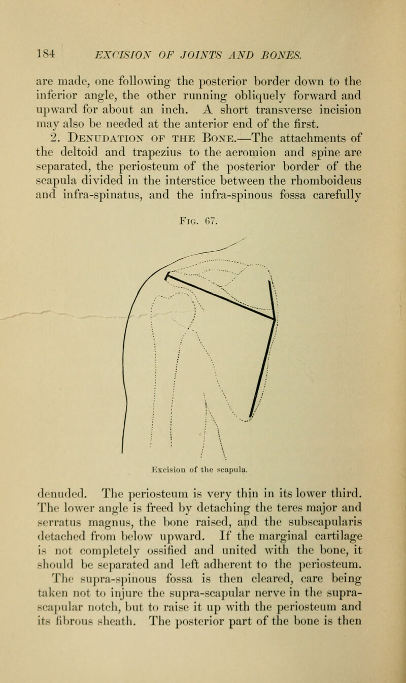 are made, one following the posterior border clown to the interior angle, the other running obliquely forward and upward for about an inch. A short transverse incision may also be needed at the anterior end of the first. •2. Denudation of the Boxe.—The attachments of the deltoid and trapezius to the acromion and spine are separated, the periosteum of the posterior border of the scapula divided in the interstice between the rhomboideus and infra-spinatus, and the infra-spinous fossa carefully Fig. 67. Excision of 111 < - scapula. denuded. The periosteum is very thin in its lower third. The lower angle is freed by detaching the teres major and serratus magnus, the bone raised, and the subscapularis detached from below upward. If the marginal cartilage ig nol completely ossified and united with the bone, it should be separated and left adherent to the periosteum. The BUpra-spinous fossa is then cleared, care being taken not to injure the supra-scapular nerve in the supra- scapular notch, but to raise it up with the periosteum and it- fibroue sheath. The posterior part of the bone is then
