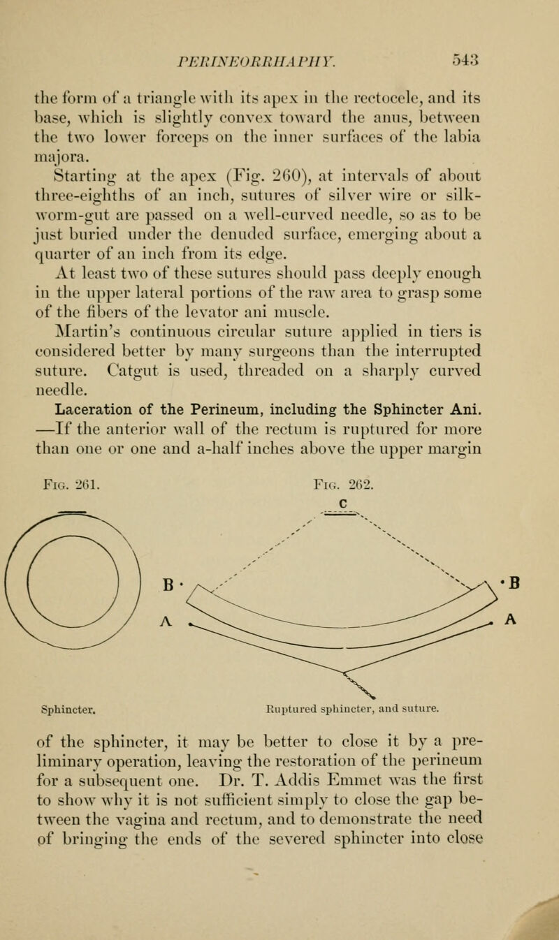 the form of a triangle with its apex in the rectocele, and its base, which is slightly convex toward the anus, between the two lower forceps on the inner surfaces of the labia majora. Starting at the apex (Fig. -<>0), at intervals of about three-eighths of an inch, sutures of silver wire or silk- worm-gut are passed on a well-curved needle, so as to be just buried under the denuded surface, emerging about a quarter of an inch from its edge. At least two of these sutures should pass deeply enough in the upper lateral portions of the raw area to grasp some of the fibers of the levator ani muscle. Martin's continuous circular suture applied in tiers is considered better by many surgeons than the interrupted suture. Catgut is used, threaded on a sharply curved needle. Laceration of the Perineum, including the Sphincter Ani. —If the anterior wall of the rectum is ruptured for more than one or one and a-half inches above the upper margin Fig. 261. ?phincter. Ruptured sphincter, and suture. of the sphincter, it may be better to close it by a pre- liminary operation, leaving the restoration of the perineum for a subsequent one. Dr. T. Addis Emmet was the first to show why it is not sufficient simply to close the gap be- tween the vagina and rectum, and to demonstrate the need of bringing the ends of the severed sphincter into close