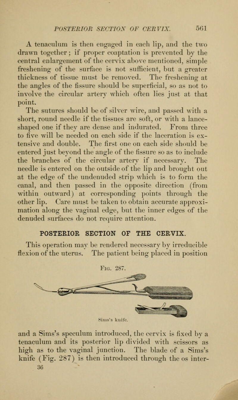 A tenaculum is then engaged in each lip, and the two drawn together; if* proper coaptation is prevented by the central enlargement of the cervix above mentioned, simple freshening of the surface is not sufficient, but a greater thickness of tissue must be removed. The freshening at the angles of the fissure should be superficial, so as not to involve the circular artery which often lies just at that point. The sutures should be of silver Avire, and passed with a short, round needle if the tissues are soft, or with a lance- shaped one if they are dense and indurated. From three to five will be needed on each side if the laceration is ex- tensive and double. The first one on each side should be entered just beyond the angle of the fissure so as to include the branches of the circular artery if necessary. The needle is entered on the outside of the lip and brought out at the edge of the undenuded strip which is to form the canal, and then passed in the opposite direction (from within outward) at corresponding points through the other lip. Care must be taken to obtain accurate approxi- mation along the vaginal edge, but the inner edges of the denuded surface- do not require attention. POSTERIOR SECTION OF THE CERVIX. This operation may be rendered necessary by irreducible flexion of the uterus. The patient being placed in position Fig. 287. Sims'> knife. and a Sims's speculum introduced, the cervix is fixed by a tenaculum and its posterior lip divided with scissors as high as to the vaginal junction. The blade of a Sims's knife (Fig. 287) is then introduced through the os inter- 36