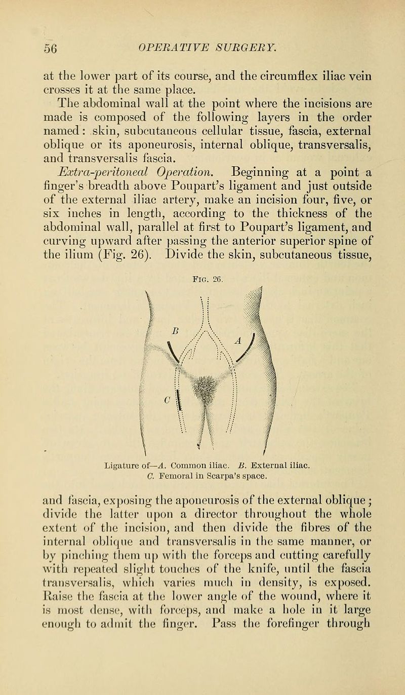 at the lower part of its course, and the circumflex iliac vein crosses it at the same place. The abdominal wall at the point where the incisions are made is composed of the following layers in the order named: skin, subcutaneous cellular tissue, fascia, external oblique or its aponeurosis, internal oblique, transversalis, and transversalis fascia. Extraperitoneal Operation. Beginning at a point a finger's breadth above Poupart's ligament and just outside of the external iliac artery, make an incision four, five, or six inches in length, according to the thickness of the abdominal wall, parallel at first to Poupart's ligament, and curving upward after passing the anterior superior spine of the ilium (Fig. 26). Divide the skin, subcutaneous tissue, Fig. 26. Ligature of— A. Common iliac. B. External iliac. C. Femoral iu Scarpa's space. and fascia, exposing the aponeurosis of the external oblique; divide the latter upon a director throughout the whole extent of the incision, and then divide the fibres of the internal oblique and transversalis in the same manner, or by pinching them up with the forceps and cutting carefully with repeated slight touches of the knife, until the fascia transversalis, which varies much in density, is exposed. Raise the fascia at the lower angle of the wound, where it is most dense, with forceps, and make a hole in it large enough to admit the finger. Pass the forefinger through
