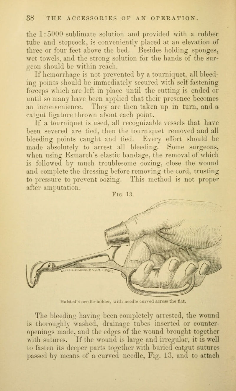 the 1: 5< >00 sublimate solution and provided with a rubber tube and stopcock, is conveniently placed at an elevation of three or four feet above the bed. Besides holding sponges, wet towels, and the strouf^ solution for the hands of the sur- geon should be within reach. If hemorrhage is not prevented by a tourniquet, all bleed- ing points should be immediately secured with self-fastening forcejts which are left in place until the cutting is ended or until so many have been applied that their presence becomes an inconvenience. They are then taken up in turn, and a catgut ligature thrown about each point. If a tourniquet is used, all recognizable vessels that have been severed are tied, then the tourniquet removed and all bleeding points caught and tied. Every effort should be made absolutely to arrest all bleeding. Some surgeons, when usino- Esmarch's elastic bandacre, the removal of which is followed by much troublesome oozing, close the wound and complete the dressing before removing the cord, trusting to pressure to prevent oozing. This method is not proper after amputation. Fig. 13. Halsted's needle-holder, with ueedle curved across the flat. The bleediiiLT having been completely arrested, the wound is thoroucrhlv Avashed, drainaire tubes inserted or counter- openings made, and the edges of the wound brought together with sutures. If the wound is large and irregular, it is well to fasten its deeper parts together with buried catgut sutures passed by means of a curved needle, Fig. 13, and to attach