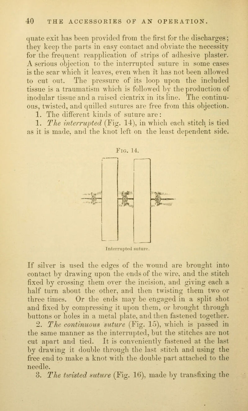 qiiate exit has been provided from the first for the discharges; they keep the parts in easy contact and obviate the necessity for the frequent reapplication of strips of adhesive plaster. A serious objection to the interrupted suture in some cases is the scar which it leaves, even Avhen it has not been allowed to cut out. The pressure of its loop upon the included tissue is a traumatism which is followed by the production of inodular tissue and a raised cicatrix in its line. The continu- ous, twisted, and quilled sutures are free from this objection. 1. The different kinds of suture are: 1. The interrupted (Fig. 1-4), in which each stitch is tied as it is made, and the knot left on the least dependent side. Fig. 14. Interrupted suture. If silver is used the edges of the wound are brought into contact by drawing upon the ends of the wire, and the stitch fixed by crossing them over the incision, and giving each a half turn about the other, and then twisting them two or three times. Or the ends may be engaged in a split shot and fixed by compressing it upon them, or brought through buttons or holes in a metal plate, and then fastened together. 2. The continuous suture (Fig. 15), which is passed in the same manner as the interrupted, but the stitches are not cut apart and tied. It is conveniently fastened at the last by drawing it double through the last stitch and using the free end to make a knot with the double part attached to the needle. 3. The twisted suture (Fig. KJ). made by transfixing the