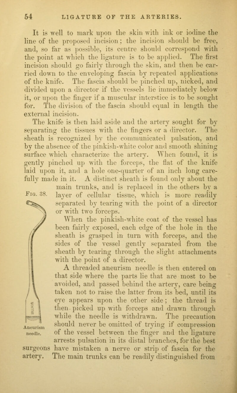 It is well to mark upon the skin with ink or iodine the line of the proposed incision; the incision should be fi'ee, and, so far as possible, its centre should correspond with the point at which the ligature is to be applied. The first incision should o-o fairly throuirh the skin, and then be car- ried down to the enveloping fascia by repeated applications of the knife. The fascia should be pinched uj), nicked, and divided upon a director if the vessels lie immediately below it, or upon the finger if a muscular interstice is to be sought for. The division of the fascia should equal in length the external incision. The knife is then laid aside and the arterv souo:ht for bv separating the tissues with the fingers or a director. The sheath is recognized by the communicated pulsation, and by the absence of the pinkish-white color and smooth shining surface which characterize the artery. AY hen found, it is gently pinched up with the forceps, the flat of the knife laid upon it, and a hole one-quarter of an inch long care- fully made in it. A distinct sheath is found only about the main trunks, and is replaced in the others by a layer of cellular tissue, which is more readily separated by tearing with the point of a director or with two forceps. When the pinkish-white coat of the vessel has been fairly exposed, each edge of the hole in the sheath is grasped in turn with forceps, and the sides of the vessel gently separated from the sheath by tearins: through the sliorht attachments with the point of a director. A threaded aneurism needle is then entered on that side where the parts lie that are most to be avoided, and passed behind the artery, care being taken not to raise the latter from its bed, until its eye appears upon the other side; the thread is then picked up with forceps and drawn through while the needle is withdrawn. The precaution should never be omitted of trying if compression needle. of the vcsscl betwecu the fin2:er and the ligature arrests pulsation in its distal branches, for the best surgeons have mistaken a nerve or strip of fascia for the artery. The main trunks can be readily distinguished from Fig. 38.