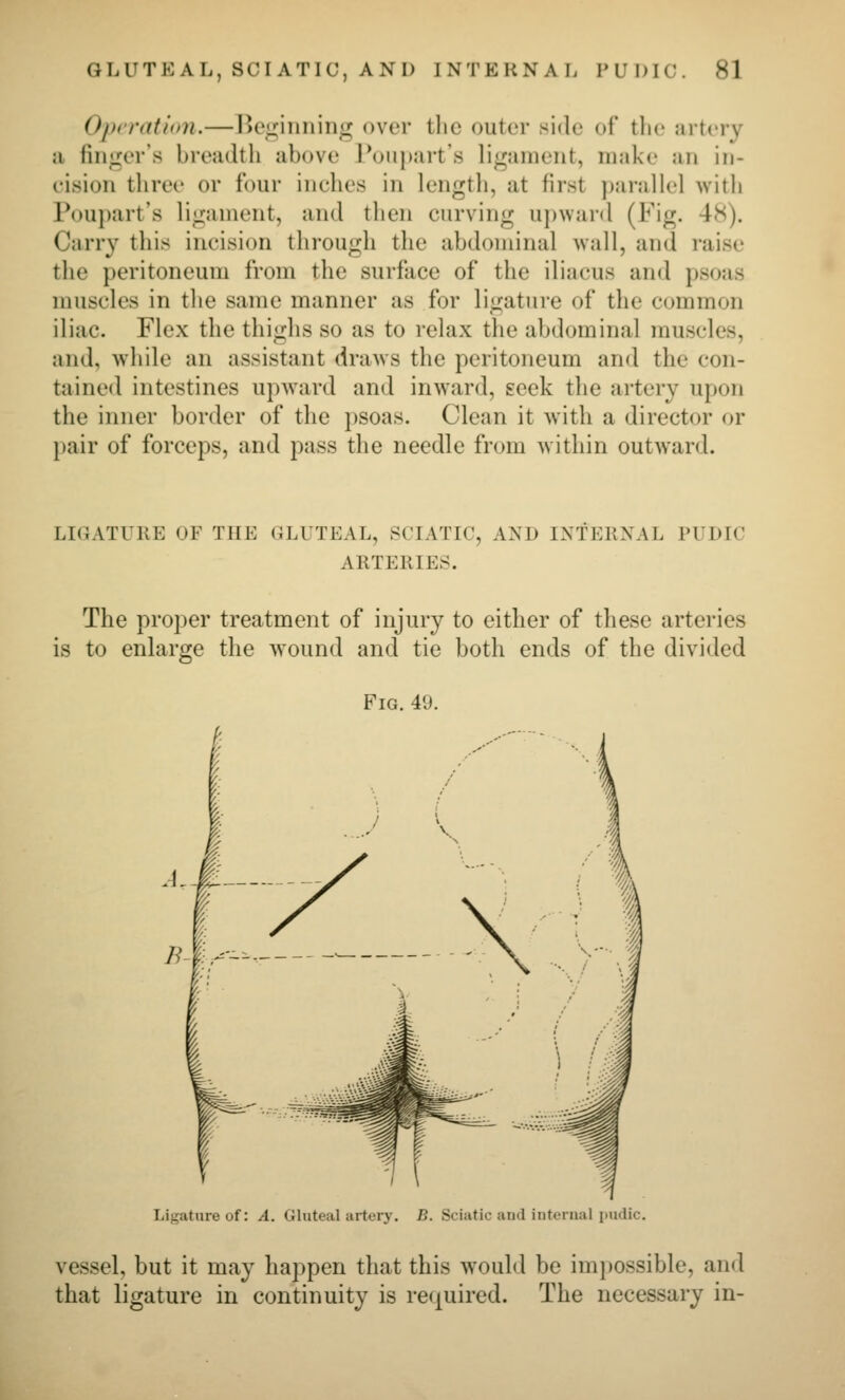 O/nratf'on.—I>('iriiinini»; over tlic outer side of tlic urtery a fiii<^or's breadth above I'oiipart'.s ligament, make an in- cision tliree or four inches in lengtli, at first parallel with Poupart's li<j:ament, and then curving upward (Fig. 48). Carry this incision through the abdominal wall, and raise the peritoneum from the surface of the iliacus and psoas muscles in the same manner as for ligature of the common iliac. Flex the thighs so as to relax the abdominal muscles, and, while an assistant draws the peritoneum and the con- tained intestines upward and inward, seek the artery upon the inner border of the psoas. Clean it with a director or pair of forceps, and pass the needle from within outward. LIOATURE OF THE GLUTEAL, SCIATIC, AND INTERNAL PUDIC ARTERIES. The proper treatment of injury to either of these arteries is to enlarge the wound and tie both ends of the divided Fig. 49. Ligature of: A. Gluteal artery. B. Sciatic and internal pudic. vessel, but it may happen that this would be impossible, and that ligature in continuity is required. The necessary in-