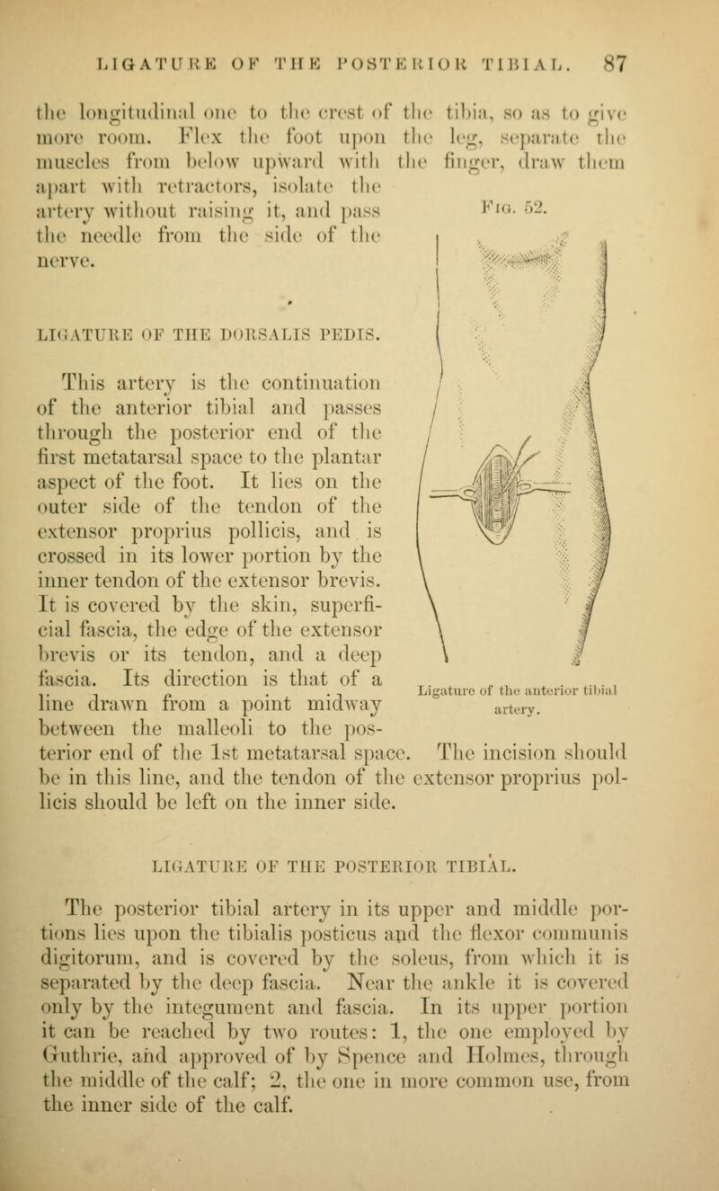 tlie longitudinal one to tlie crost of tlic tibia, so as to give more room. Flex tlie foot upon the leg, separate tlie muscles from below upward with tlie finger, draw them apart with retractors, isolate the artery -without raising it, and pass ^^'^*- •^'-• the needle from the side of the i nerve. I ^^f^i^i^iif^^' ■ LIGATURE OF THE DORSALLS PEDIS. This artery is the continuation of the anterior tibial and passes through the posterior end of the first metatarsal space to the plantar aspect of the foot. It lies on the outer side of the tendon of the extensor proprius pollicis, and is crossed in its lower portion b}^ the inner tendon of the extensor brevis. It is covered by the skin, superfi- cial fascia, the edge of the extensor brevis or its tendon, and a deep fascia. Its direction is that of a line drawn from a point midway between the malleoli to the pos- terior end of the 1st metatarsal space. The incision be in this line, and the tendon of the extensor propri licis should be left on the inner side. Ligature of the anterior tibial artery. should us pol- LIGATURE OF THE POSTERIOR TIBIAL. The posterior tibial artery in its upper and middle por- tions lies upon the tibialis posticus and the flexor eonmiunis digitorum, and is covered by the soleus, from which it is separated by the deep fascia. Near the ankle it is covered only by the integument and fascia. In its upper portion it can be reached by two routes: 1, the one employed by Guthrie, and approved of by Spence and Holmes, through the middle of the calf; 2, the one in more common use, from the inner side of the calf.