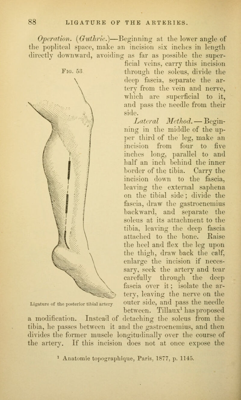 Operation. [Guthrie.)—Beginning at the lower angle of the popliteal space, make an incision six inches in length directly downward, avoiding as far as possible the super- ficial veins, carry this incision through the soleus, divide the deep fascia, separate the ar- tery from the vein and nerve, which are superficial to it, and pass the needle from their side. Lateral 3IetJwd. — Begin- ning in the middle of the up- per third of the leg, make an incision from four to five inches long, parallel to and half an inch behind the inner border of the tibia. Carry the incision down to the fascia, leaving the external saphena on the tibial side; divide the fascia, draw the gastrocnemius backward, and separate the soleus at its attachment to the tibia, leaving the deep fascia attached to the bone. Kaise the heel and flex the leg upon the thigh, draw back the calf, enlarge the incision if neces- sary, seek the artery and tear carefully through the deep fascia over it; isolate the ar- tery, leaving the nerve on the outer side, and pass the needle between. Tillaux^ has proposed a modification. Instead of detachino- tlie soleus from the tibia, he passes between it and the gastrocnemius, and then divides the former muscle longitudinally over the course of the artery. If this incision does not at once expose the Ligature of the posterior tibial artery ^ Anatomie topograpliique, Paris. 1877, p. 114-5.