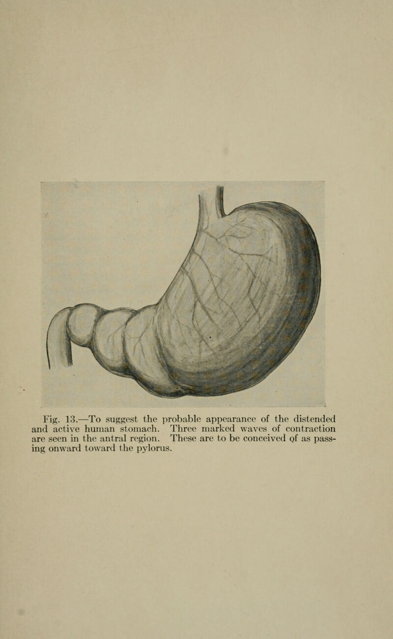 Fig. 13.—To suggest the probable appearance of the distended and active human stomach. Three marked waves of contraction are seen in the antral region. These are to be conceived gf as pass- ing onward toward the pjdorus.