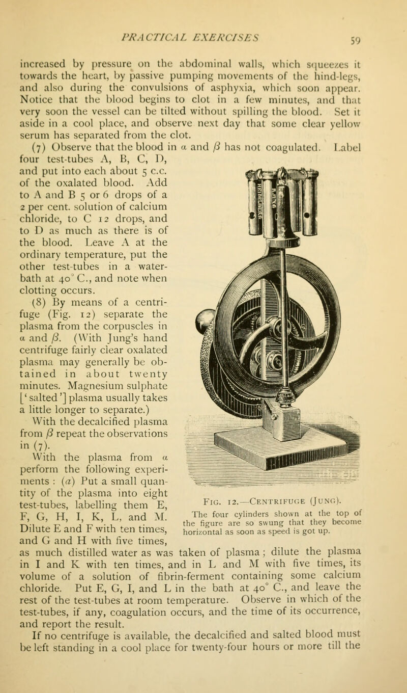 PR A CTICA L EXERCISES increased by pressure on the abdominal walls, which sijueezes it towards the heart, by passive pumping movements of the hind-legs, and also during the convulsions of asphyxia, which soon appear. Notice that the blood begins to clot in a few minutes, and that very soon the vessel can be tilted without spilling the blood. Set it aside in a cool place, and observe next day that some clear yellow serum has separated from the clot. (7) Observe that the blood in a and /3 has not coagulated. Label four test-tubes A, B, C, D, and put into each about 5 c.c. of the oxalated blood. Add to A and B 5 or 6 drops of a 2 per cent, solution of calcium chloride, to C 12 drops, and to D as much as there is of the blood. Leave A at the ordinary temperature, put the other test-tubes in a water- bath at 40' C, and note when clotting occurs. (8) By means of a centri- fuge (Fig. 12) separate the plasma from the corpuscles in a and (i. (With Jung's hand centrifuge fairly clear oxalated plasma may generally be ob- tained in about twenty minutes. Magnesium sulphate [' salted'] plasma usually takes a little longer to separate.) With the decalcified plasma from (3 repeat the observations in (7). With the plasma from a perform the following experi- ments : {a) Put a small quan- tity of the plasma into eight test-tubes, labelling them E, F, G, H, I, K, L, and M. Dilute E and F with ten times, and G and H with live times, as much distilled water as was taken of plasma ; dilute the plastiia in I and K with ten times, and in L and M with five times, its volume of a solution of fibrin-ferment containing some calcium chloride. Put E, G, I, and L in the bath at 40° C, and leave the rest of the test-tubes at room temperature. Observe in which of the test-tubes, if any, coagulation occurs, and the time of its occurrence, and report the result. If no centrifuge is available, the decalcified and salted blood must be left standing in a cool place for twenty-four hours or more till the Fig. 12.—Centrifui^.e (Jung). The four cylinders shown at the top of the figure are so swung that they become horizontal as soon as speed is got up.