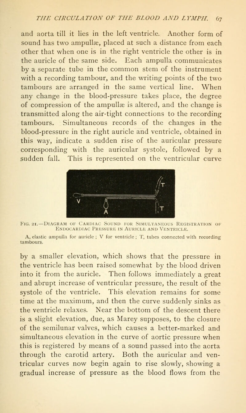 and aorta till it lies in the left ventricle. Another form of sound has two ampullae, placed at such a distance from each other that when one is in the right ventricle the other is in the auricle of the same side. Each ampulla communicates by a separate tube in the common stem of the instrument with a recording tam.bour, and the writing points of the two tambours are arranged in the same vertical line. When any change in the blood-pressure takes place, the degree of compression of the ampullae is altered, and the change is transmitted along the air-tight connections to the recording tambours. Simultaneous records of the changes in the blood-pressure in the right auricle and ventricle, obtained in this way, indicate a sudden rise of the auricular pressure corresponding with the auricular systole, followed by a sudden fall. This is represented on the ventricular curve Fig. 21.—Diagram of Cardiac Sound for Simultaneous Rkgistratkjn ok Endocardiac Pressure in Auricle and Ventricle. A, elastic ampulla for auricle ; V for ventricle ; T, tubes connected with recording tambours. by a smaller elevation, which shows that the pressure in the ventricle has been raised somewhat by the blood driven into it from the auricle. Then follows immediately a great and abrupt increase of ventricular pressure, the result of the systole of the ventricle. This elevation remains for some time at the maximum, and then the curve suddenly sinks as the ventricle relaxes. Near the bottom of the descent there is a slight elevation, due, as Marey supposes, to the closure of the semilunar valves, which causes a better-marked and simultaneous elevation in the curve of aortic pressure when this is registered by means of a sound passed into the aorta through the carotid artery. Both the auricular and ven- tricular curves now begin again to rise slowly, showing a gradual increase of pressure as the blood flows from the