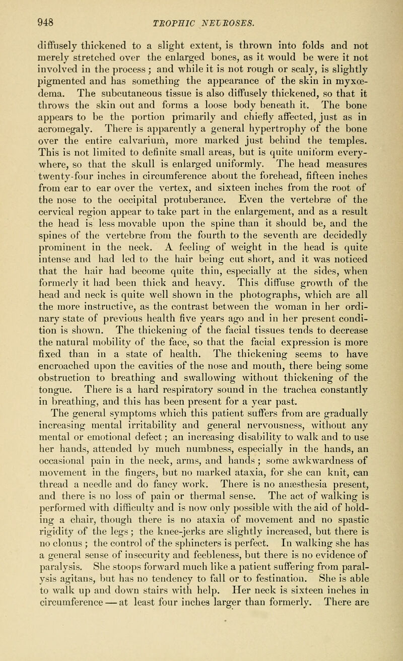 cliifusely thickened to a slight extent, is thrown into folds and not merely stretched over the enlarged bones, as it would be were it not involved in the process ; and while it is not rough or scaly, is slightly pigmented and has something the appearance of the skin in myxoe- deraa. The subcutaneous tissue is also diifusely thickened, so that it throws the skin out and forms a loose body beneath it. The bone appears to be the portion primarily and chiefly affected, just as in acromegaly. There is apparently a general hypertrophy of the bone over the entire calvariura, more marked just behind the temples. This is not limited to definite small areas, but is quite uniform every- where, so that the skull is enlarged uniformly. The head measures twenty-four inches in circumference about the forehead, fifteen inches from ear to ear over the vertex, and sixteen inches from the root of the nose to the occipital protuberance. Even the vertebrae of the cervical region appear to take part in the enlargement, and as a result the head is less movable upon the spine than it should be, and the spines of the vertebrae from the fourth to the seventh are decidedly prominent in the neck. A feeling of weight in the head is quite intense and had led to the hair being cut short, and it was noticed that the hair had become quite thin, especially at the sides, when formerly it had been thick and heavy. This diflFuse growth of the head and neck is quite well shown in the photographs, which are all the more instructive, as the contrast between the woman in her ordi- nary state of previous health five years ago and in her present condi- tion is shown. The thickening of the facial tissues tends to decrease the natural mobility of the face, so that the facial expression is more fixed than in a state of health. The thickening seems to have encroached upon the cavities of the nose and mouth, there being some obstruction to breathing and swallowing without thickening of the tongue. There is a hard respiratory sound in the trachea constantly in breathing, and this has been present for a year past. The general symptoms which this patient suffers from are gradually increasing mental irritability and general nervousness, without any mental or emotional defect; an increasing disability to walk and to use her hands, attended by much numbness, especially in the hands, an occasional pain in the neck, arms, and hands; some awkwardness of movement in the fingers, but no marked ataxia, for she can knit, can thread a needle and do fancy work. There is no anaesthesia present, and there is no loss of pain or thermal sense. The act of walking is performed with difficulty and is now only possible with the aid of hold- ing a chair, though there is no ataxia of movement and no spastic rigidity of the legs; the knee-jerks are slightly increased, but there is no clonus ; the control of the sphincters is perfect. In walking she has a general sense of insecurity and feebleness, but there is no evidence of paralysis. She stoops forward much like a patient suffering from paral- ysis agitans, but has no tendency to fall or to festinatiou. She is able to walk up and down stairs with help. Her neck is sixteen inches in circumference — at least four inches larger than formerly. There are