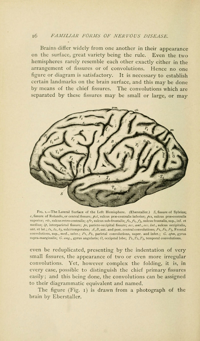 Brains differ widely from one another in their appearance on the surface, great variety being the rule. Even the two hemispheres rarely resemble each other exactly either in the arrangement of fissures or of convolutions. Hence no one figure or diagram is satisfactory. It is necessary to establish certain landmarks on the brain surface, and this may be done by means of the chief fissures. The convolutions which are separated by these fissures may be small or large, or may Fig. i.—The Lateral Surface of the Left Hemisphere. (Eberstaller.) S, fissure of Sylvius; c, fissure of Rolando, or central fissure; pet, sulcus prae-centralis inferior; pes, sulcus pra;-centralis superior; rtc, sulcus retro-centralis; s/r, sulcus sub-frontalis;/i,/2,y3, sulcus frontalis, sup., inf. et medius; ip, interparietal fissure; pa, parieto-occipital fissure; occ. ant., occ. Int., sulcus occipitalis, ant. et lat.; ti, ti, t$, sulci temporales; A,B,ant. and post, central convolutions; F\, F2, ^3, Frontal convolutions, sup., med., infer.; Pi, P2, parietal convolutions, super, and infer.; G. spm, gyrus supra-marginalis; G. ctng., gyrus angularis; O, occipital lobe; 7*i, 7*2, 7*3, temporal convolutions. even be reduplicated, presenting by the indentation of very small fissures, the appearance of two or even more irregular convolutions. Yet, however complex the folding, it is, in every case, possible to distinguish the chief primary fissures easily; and this being done, the convolutions can be assigned to their diagrammatic equivalent and named. The figure (Fig. i) is drawn from a photograph of the brain by Eberstaller.