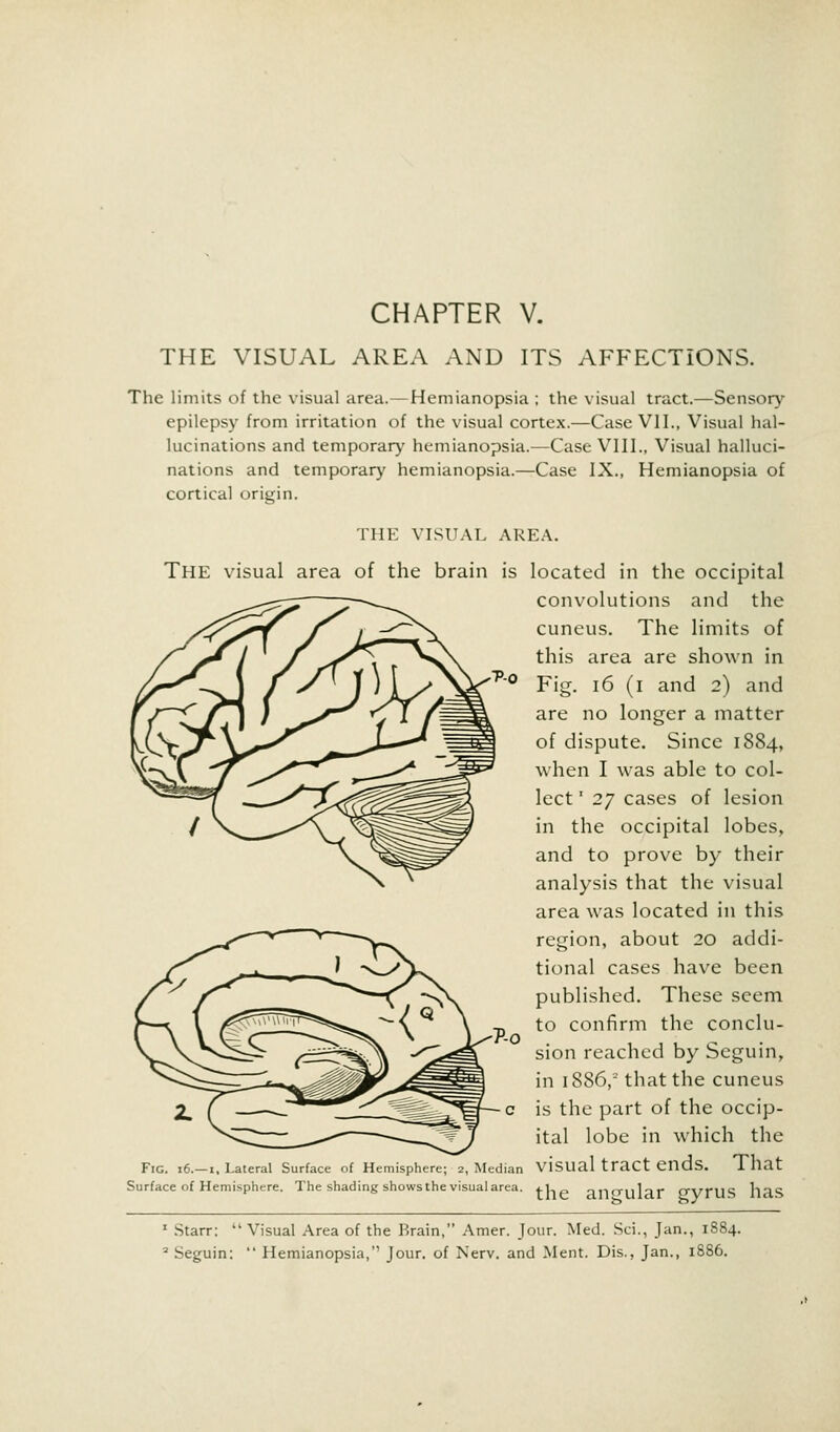 CHAPTER V. THE VISUAL AREA AND ITS AFFECTIONS. The limits of the visual area.—Hemianopsia ; the visual tract.—Sensory epilepsy from irritation of the visual cortex.—Case VII., Visual hal- lucinations and temporary hemianopsia.—Case VIII., Visual halluci- nations and temporary hemianopsia.—Case IX., Hemianopsia of cortical origin. THE VISUAL AREA. THE visual area of the brain is located in the occipital convolutions and the cuneus. The limits of this area are shown in Fig. 16 (i and 2) and are no longer a matter of dispute. Since 1884, when I was able to col- lect ' 27 cases of lesion in the occipital lobes, and to prove by their analysis that the visual area was located in this region, about 20 addi- tional cases have been published. These seem to confirm the conclu- sion reached by Scguin, in 1886,2 that the cuneus is the part of the occip- ital lobe in which the Fig. 16.—i. Lateral Surface of Hemisphere; 2, Median visual tract ends. That Surface of Hemisphere. The shading shows the visual area. fUP anrrnlar rryniS lllS 1 Starr:  Visual Area of the Brain, Amer. Jour. Med. Sci., Jan., 1884. 2 Seguin:  Hemianopsia, Jour, of Nerv. and Ment. Dis., Jan., 1886.