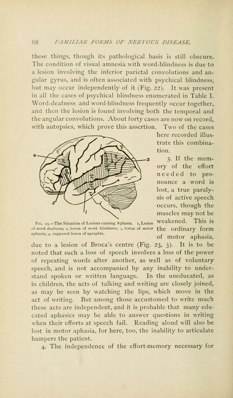 these things, though its pathological basis is still obscure. The condition of visual amnesia with word-blindness is due to a lesion involving the inferior parietal convolutions and an- gular gyrus, and is often associated with psychical blindness, but may occur independently of it (Fig. 22). It was present in all the cases of psychical blindness enumerated in Table I. Word-deafness and word-blindness frequently occur together, and then the lesion is found involving both the temporal and the angular convolutions. About forty cases are now on record, with autopsies, which prove this assertion. Two of the cases here recorded illus- trate this combina- tion. 3. If the mem- ory of the effort needed to pro- nounce a word is lost, a true paraly- sis of active speech occurs, though the muscles may not be Fig. 23.—The Situation of Lesions causing Aphasia, i, Lesion WeaKenea. 1 IllS IS of word deafness; 2, lesion of word blindness; 3, lesion of motor the Ordinary form aphasia; 4, supposed lesion of agraphia. of motor aphasia, due to a lesion of Broca's centre (Fig. 23, 3). It is to be noted that such a loss of speech involves a loss of the power of repeating words after another, as well as of voluntary speech, and is not accompanied by any inability to under- stand spoken or written language. In the uneducated, as in children, the acts of talking and writing are closely joined, as may be seen by watching the lips, which move in the act of writing. But among those accustomed to write much these acts are independent, and it is probable that many edu- cated aphasics may be able to answer questions in writing when their efforts at speech fail. Reading aloud will also be lost in motor aphasia, for here, too, the inability to articulate hampers the patient. 4. The independence of the effort-memory necessary for