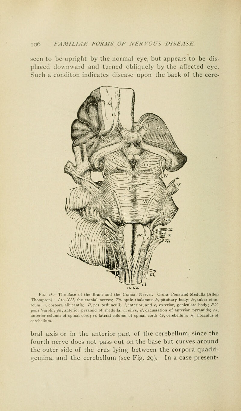 seen to be upright by the normal eye, but appears to be dis- placed downward and turned obliquely by the affected eye. Such a conditon indicates disease upon the back of the cere- cl La Fig. 28.—The Base of the Brain and the Cranial Nerves. Crura, Pons and Medulla (Allen Thompson;, /to XII, the cranial nerves; T/i, optic thalamus; h, pituitary body; /c, tuber cine- reum; a, corpora albicantia; /', pes pedunculi; i, interior, and e, exterior, geniculate body; PV, pons Varolii; /a, anterior pyramid of medulla; 0, olive; a', decussation of anterior pyramids; cay anterior column of spinal cord; c/, lateral column of spinal cord; C>, cerebellum; y7, flocculus of cerebellum. bral axis or in the anterior part of the cerebellum, since the fourth nerve does not pass out on the base but curves around the outer side of the crus lying between the corpora quadri- gemina, and the cerebellum (see Fig. 29). In a case present-