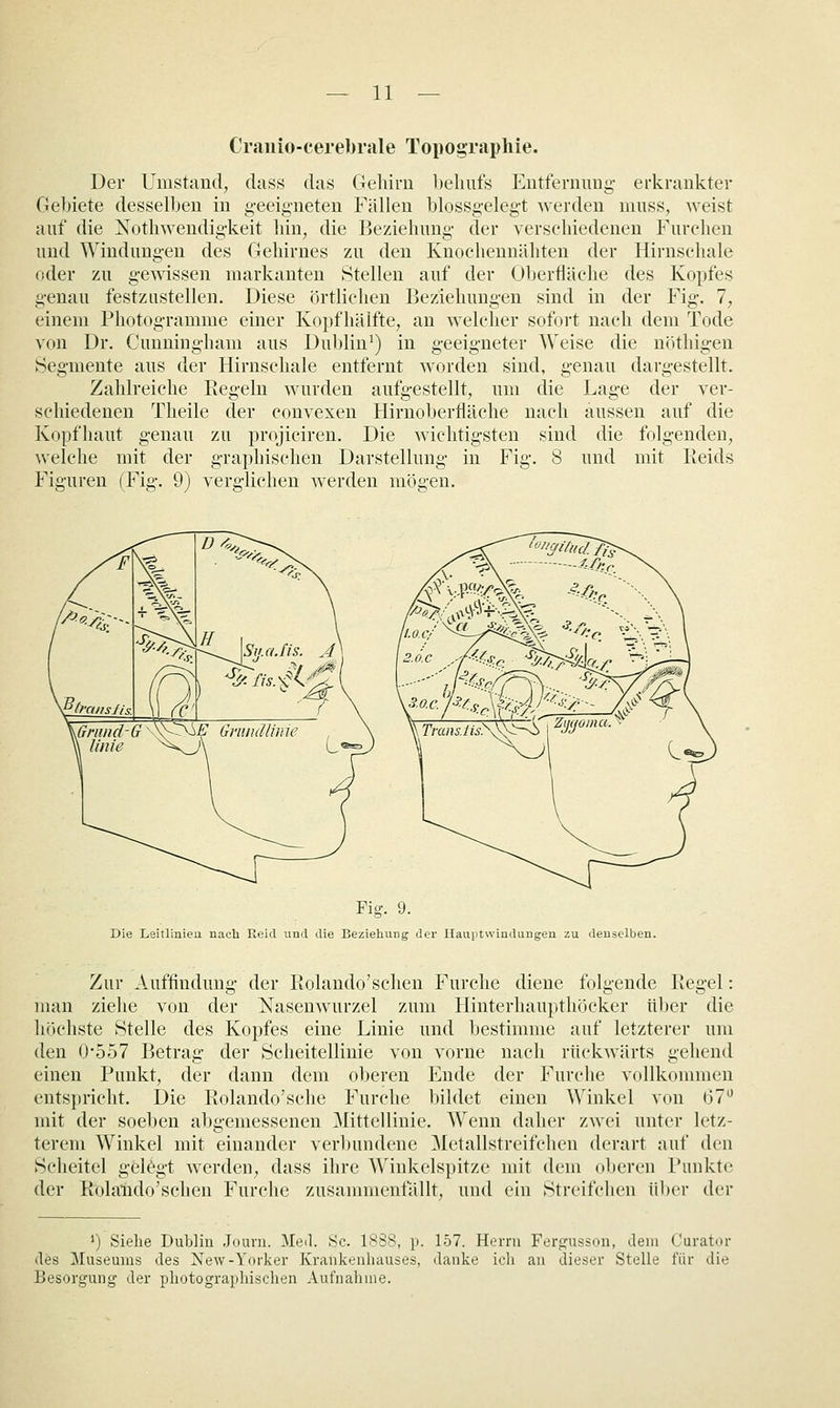 Crauio-cerebrale Topographie. Der Umstand, dass das Gehirn behufs Entfernung erkrankter Gebiete desselben in g-eeigneten Fallen blossgelegt werden muss, weist auf die Nothwendigkeit hin, die Beziehung- der verschiedenen Furchen und Windungen des Gehirnes zu den Knochennähten der Hirnschale oder zu gewissen markanten Stellen auf der Oberfläche des Kopfes genau festzustellen. Diese örtlichen Beziehungen sind in der Fig. 1, einem Photogramme einer Kopfhäifte, an welcher sofoi't nach dem Tode von Dr. Cunningham aus Dublin') in geeigneter Weise die nöthigen Segmente aus der Hirnschale entfernt worden sind, genau dargestellt. Zahlreiche Regeln wurden aufgestellt, um die Lage der ver- schiedenen Theile der convexen Hirnoberfläche nach aussen auf die Kopfhaut genau zu projiciren. Die wichtigsten sind die folgenden, \velche mit der graphischen Darstellung in Fig. 8 und mit lieids Figuren (Fig. 9) verglichen werden mögen. Fig. 9. Die Leitlinieu nach Reid und die Beziehung der Hauptwindungen zu denselben. Zur Auffindung der Rolando'sehen Furche diene folgende Regel: man ziehe von der Nasenwurzel zum Hinterhaupthöcker über die höchste Stelle des Kopfes eine Linie und bestimme auf letzterer um den ()-557 Betrag der Scheitellinie von vorne nach rückwärts gehend einen Punkt, der dann dem oberen Ende der Furche vollkommen entspricht. Die Rolando'sche Furche bildet einen Winkel von 67 mit der soeben abgemessenen Mittellinie. Wenn daher ZAvei unter letz- terem Winkel mit einander verliundene Metallstreifchen derart auf den Scheitel gelegt werden, dass ihre Winkelspitze mit dem oberen Punkte der Rolaiido'sehen Furche zusammenfällt, und ein Streifchen über der ') Siehe Dublin Journ. Med. 8c. 1888, p. 157. Herrn Fergusson, dem Curator des Museums des New-Yorker Krankenhauses, danke ich an dieser Stelle für die Besorgung der photographischen Aufiialiiiie.