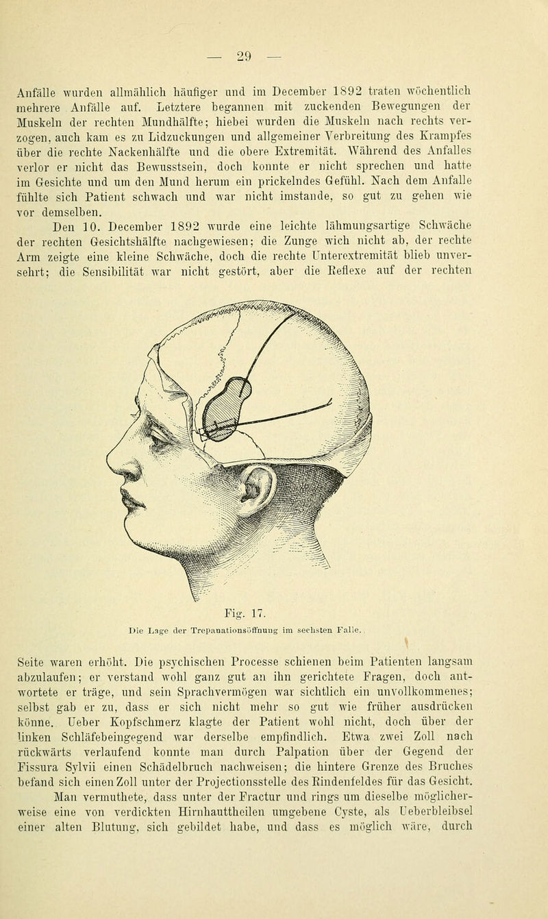 Anfälle wurden allmählich häufiger und im Deceraber 1892 traten wöchentlich mehrere Anfälle auf. Letztere begannen mit zuckenden Bewegungen der Muskeln der rechten Mundhälfte; hiebei wurden die Muskeln nach rechts ver- zogen, auch kam es zu Lidzuckungen und allgemeiner Verbreitung des Krampfes über die rechte Nackenhälfte und die obere Extremität. Während des Anfalles verlor er nicht das Bewusstsein, doch konnte er nicht sprechen und hatte im Gesichte und um den Mund herum ein prickelndes Gefühl. Nach dem Anfalle fühlte sich Patient schwach und war nicht imstande, so gut zu gehen wie vor demselben. Den 10. December 1892 wurde eine leichte lähmungsartige Schwäche der rechten Gesichtshälfte nachgewiesen; die Zunge wich nicht ab, der rechte Arm zeigte eine kleine Schwäche, doch die rechte Unterextremität blieb unver- sehrt; die Sensibilität war nicht gestört, aber die Eeflexe auf der rechten Fig. 17. Die Lage der Trepanationsüffnung im sechsten Falle., Seite waren erhöht. Die psychischen Processe schienen beim Patienten langsam abzulaufen; er verstand wohl ganz gut an ihn gerichtete Fragen, doch ant- wortete er träge, und sein Sprachvermögen war sichtlich ein unvollkommenes; selbst gab er zu, dass er sich nicht mehr so gut wie früher ausdrücken könne, lieber Kopfschmerz klagte der Patient wohl nicht, doch über der Unken Schläfebeingegend war derselbe empfindlich. Etwa zwei Zoll nach rückwärts verlaufend konnte man durch Palpation über der Gegend der Pissura Sylvii einen Schädelbruch nachweisen; die hintere Grenze des Bruches befand sich einen Zoll unter der Projectionsstelle des Eindenfeldes für das Gesicht. Man vermuthete, dass unter der Fractur und rings um dieselbe möglicher- weise eine von verdickten Hirnhautthcilen umgebene Cyste, als Ueberbleibsel einer alten Blutung, sich gebildet habe, und dass es möglich Aväre, durch