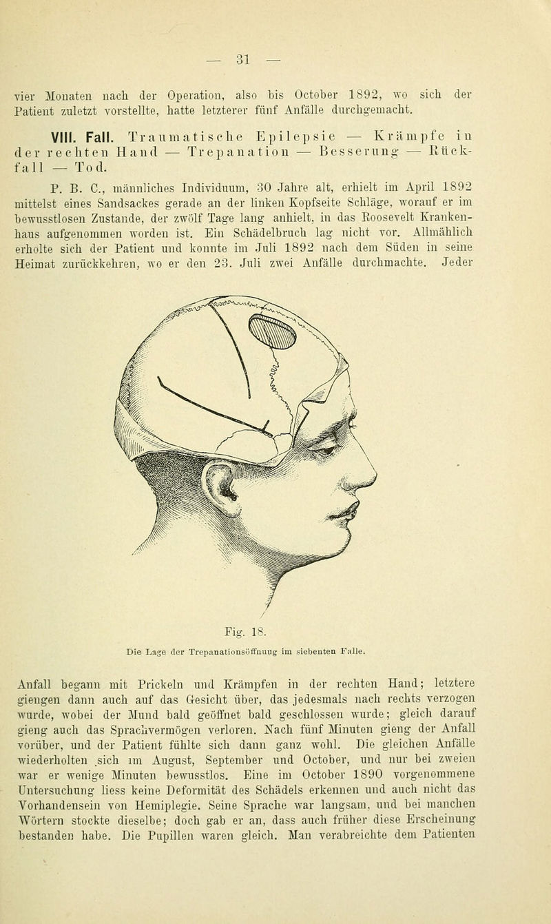 vier ]\Ionaten nach der Operation, also bis October 1892, wo sich der Patient zuletzt vorstellte, hatte letzterer fünf Anfälle durchgemacht. VIII. Fall. Traumatische Epilepsie — Krämpfe in der rechten Hand — Trepanation — Besserung — Rück- fall — Tod. P. B. C, männliches Individuum, 30 Jahre alt, erhielt im April 1892 mittelst eines Sandsackes gerade an der linken Kopfseite Schläge, worauf er im bewusstlosen Zustande, der zwölf Tage lang anhielt, in das Eoosevelt Kranken- haus aufgenommen worden ist. Ein Schädelbruch lag nicht vor. Allmählich erholte sich der Patient und konnte im Juli 1892 nach dem Süden in seine Heimat zurückkehren, wo er den 23. Juli zwei Anfälle durchmachte. Jeder / Fig. 18. Die Lage der Trepanationsöffnuug im siebenten Falle. Anfall begann mit Prickeln und Krämpfen in der rechten Hand; letztere giengen dann auch auf das Oesicht über, das jedesmals nach rechts verzogen wurde, wobei der Mund bald geöffnet bald geschlossen wurde; gleich darauf gieng auch das Sprachvermögen verloren. Nach fünf Minuten gieng der Anfall vorüber, und der Patient fühlte sich dann ganz wohl. Die gleichen Anfälle wiederholten .sich im August, September und October, und nur bei zweien war er wenige Minuten bewusstlos. Eine im October 1890 vorgenommene Untersuchung Hess keine Deformität des Schädels erkennen und auch nicht das Vorhandensein von Hemiplegie. Seine Sprache war langsam, und bei manchen Wörtern stockte dieselbe; doch gab er an, dass auch früher diese Erscheinung bestanden habe. Die Pupillen waren gleich. Man verabreichte dem Patienten