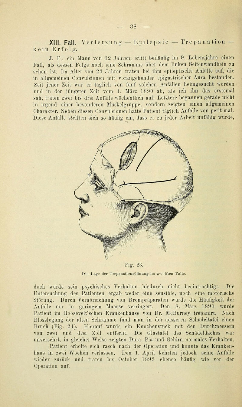 Xiil. Fall. Yerletzung — Epilepsie — Trepanation — kein Erfolg. J. F., ein Mann von 32 Jahren, erlitt beiläufig im 9. Lebensjahre einen Fall, als dessen Folge noch eine Schramme über dem linken Seitenwandbein zu sehen ist. Im Alter von 23 Jahren traten bei ihm epileptische Anfalle auf, die in allgemeinen Convulsionen mit vorangehender epigastrischer Aura bestanden. Seit jener Zeit war er täglich von fünf solchen Anfällen heimgesucht worden und in der jüngsten Zeit vom 1. März 1890 ab, als ich ihn das erstemal sah, traten zwei bis drei Anfälle wöchentlich auf. Letztere begannen gerade nicht in irgend einer besonderen Muskelgruppe, sondern zeigten einen allgemeinen Charakter. Neben diesen Convulsionen hatte Patient täglich Anfälle von petit mal. Diese Anfälle stellten sich so häufig ein, dass er zu jeder Arbeit unfähig wurde, Fig. 23. Die Lage der Trepanationsöff'nung im zwölften FaUe. doch wurde sein psychisches Verhalten hiedurch nicht beeinträchtigt. Die Untersuchung des Patienten ergab weder eine sensible, noch eine motorische Störung. Durch Verabreichung von Brompräparaten wurde die Häufigkeit der Anfälle nur in geringem Maasse verringert. Den 8. März 1890 wurde Patient im Eoosevelt'schen Krankenhause von Dr. McBurney trepanirt. Nach Blosslegung der alten Schramme fand man in der äusseren Schädeltafei einen Bruch (Fig. 24). Hierauf wurde ein Xnochenstück mit den Durchmessern von zwei und drei Zoll entfernt. Die Glastafel des Schädeldaches war unversehrt, in gleicher Weise zeigten Dura, Pia und Gehirn normales Verhalten. Patient erholte sich rasch nach der Operation und konnte das Kranken- haus in zwei Wochen verlassen. Den 1. April kehrten jedoch seine Anfälle wieder zurück und traten bis October 1892 ebenso häufig wie vor der Operation auf.