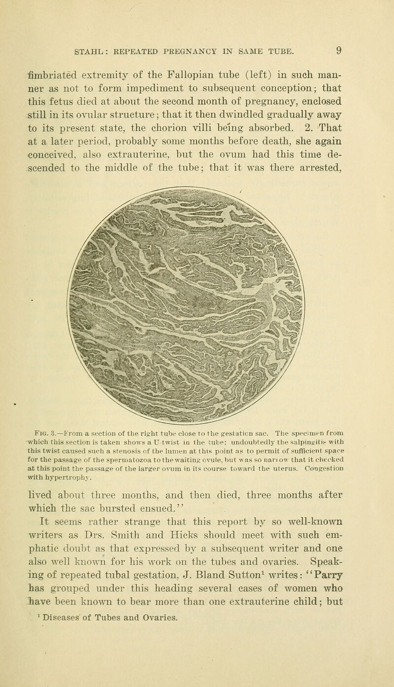 ^mbriated extremity of the Fallopian tube (left) in such man- ner as not to form impediment to subsequent conception; that this fetus died at about the second month of pregnancy, enclosed still in its o\T^ilar structure; that it then dwindled gradually away to its present state, the chorion villi being absorbed, 2. That at a later period, probably some months before death, she again conceived, also extrauterine, but the ovum had this time de- scended to the middle of the tube; that it was there arrested, Fig. 3.—From a section of the right tube close to the gestation sac. The specinien from which this section is taken shows a U-twist in the tube: undoubtedly the salpinyitis-with this twist caused such a stenosis of the lumen at this point as to permit of sufficient space for the passage of the spermatozoa to the waiting ovule, but was so nar/ ow that it checked at this point the passage of the larger ovum in its course toward the uterus. Congestion with hypertrophy. lived about three months, and then died, three months after which the sac bursted ensued. It seems rather strange that this report by so well-known writers as Drs. Smith and Hicks should meet with such em- phatic doubt as that expressed by a subsequent writer and one also well known for his work on the tubes and ovaries. Speak- ing of repeated tubal gestation, J. Bland Sutton^ writes: ''Parry has grouped under this heading several cases of women who have been known to bear more than one extrauterine child; but . ^ Diseases of Tubes and Ovaries.