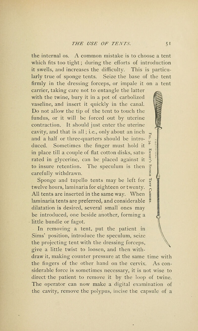 the internal os. \ common mistake is to choose a tent which fits too tight; during the efforts of introduction it swells, and increases the difficulty. This is particu- larly true of sponge tents. Seize the base of the tent firmly in the dressing forceps, or impale it on a tent carrier, taking care not to entangle the latter with the twine, bury it in a pot of carbolized vaseline, and insert it quickly in the canal. Do not allow the tip of the tent to touch the fundus, or it will be forced out by uterine contraction. It should just enter the uterine cavity, and that is all; i.e., only about an inch and a half or three-quarters should be intro- duced. Sometimes the finger must hold it in place till a couple of fiat cotton disks, satu- rated in glycerine, can be placed against it to insure retention. The speculum is then carefully withdrawn. Sponge and tupello tents may be left for twelve hours, laminariafor eighteen or twenty. All tents are inserted in the same way. When laminaria tents are preferred, and considerable dilatation is desired, several small ones may be introduced, one beside another, forming a little bundle or fagot. In removing a tent, put the patient in Sims' position, introduce the speculum, seize the projecting tent with the dressing forceps, give a little twist to loosen, and then with- draw it, making counter pressure at the same time with the fingers of the other hand on the cervix. As con- siderable force is sometimes necessary, it is not wise to direct the patient to remove it by the loop of twine. The operator can now make a digital examination of the cavity, remove the polypus, incise the capsule of a