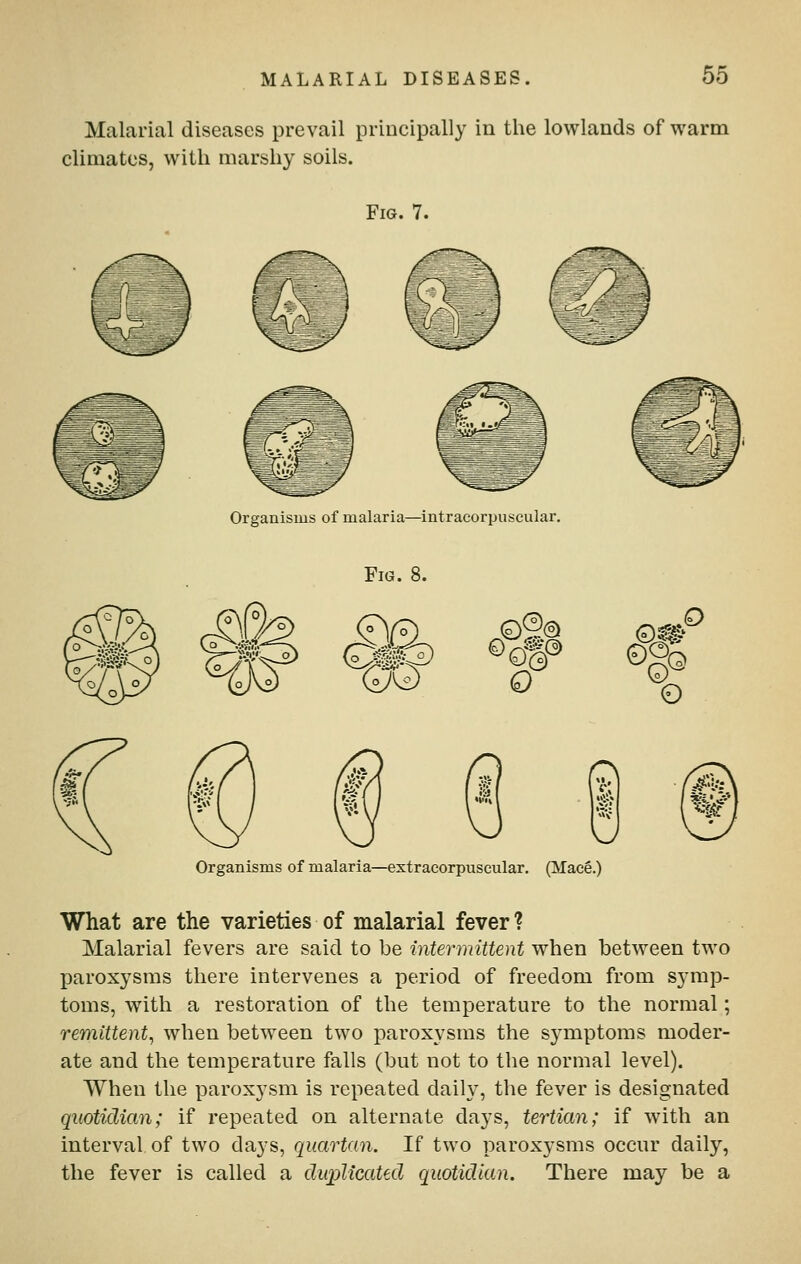 Malarial diseases prevail principally in the lowlands of warm climates, with marshy soils. Fig. 7. Organisms of malaria—intracorpiiscular. Fig. 8. QQ) Q Organisms of malaria—extracorpuseular. (MacS.) What are the varieties of malarial fever ? Malarial fevers are said to be intermittent when between two paroxysms there intervenes a period of freedom from symp- toms, with a restoration of the temperature to the normal; remittent, when between two paroxysms the symptoms moder- ate and the temperature falls (but not to the normal level). When the paroxysm is repeated daily, the fever is designated quotidian; if repeated on alternate days, tertian; if with an interval of two days, quartan. If two paroxysms occur daily, the fever is called a duplicated quotidian. There may be a