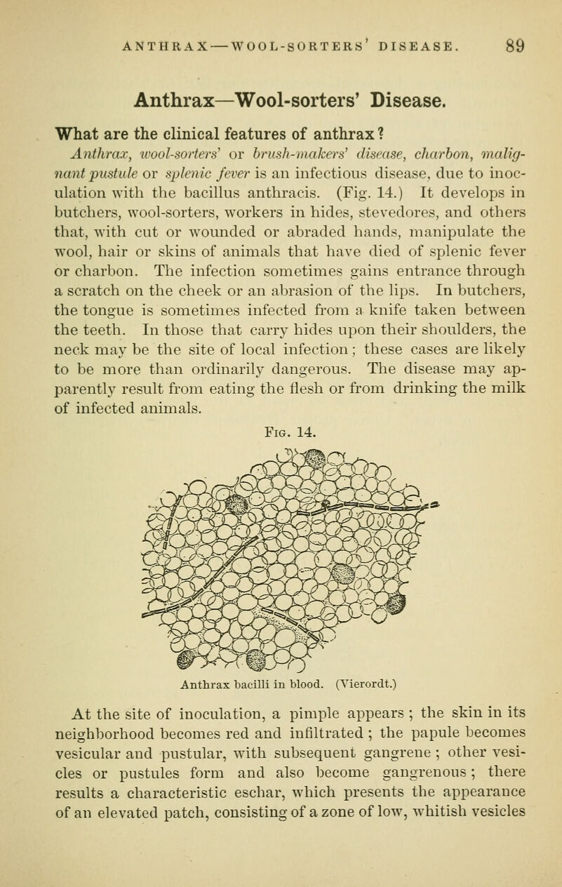 Anthrax—Wool-sorters' Disease. What are the clinical features of anthrax ? Anthrax^ loool-sorters' or brush-makers' disease, charbon, malig- nant pustule or splenic fever is an infectious disease, due to inoc- ulation with the bacillus anthracis. (Fig. 14.) It develops in butchers, wool-sorters, workers in hides, stevedores, and others that, with cut or wounded or abraded hands, manipulate the wool, hair or skins of animals that have died of splenic fever or charbon. The infection sometimes gains entrance through a scratch on the cheek or an abrasion of the lips. In butchers, the tongue is sometimes infected from a knife taken between the teeth. In those that carry hides upon their shoulders, the neck may be the site of local infection; these cases are likely to be more than ordinarily dangerous. The disease may ap- parently result from eating the flesh or from drinking the milk of infected animals. Fig. 14. Anthrax bacilli in blood. (Vierordt.) At the site of inoculation, a pimple appears ; the skin in its neighborhood becomes red and infiltrated ; the papule becomes vesicular and pustular, with subsequent gangrene ; other vesi- cles or pustules form and also become gangrenous; there results a characteristic eschar, which presents the appearance of an elevated patch, consisting of a zone of low, whitish vesicles