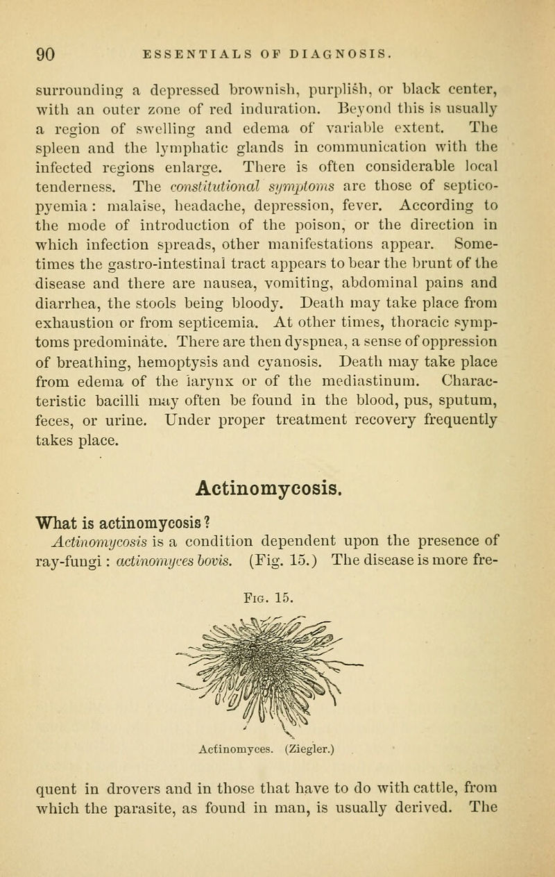 surrounding a depressed brownish, purplish, or black center, with an outer zone of red induration. Beyond this is usually a region of swellinc: and edema of variable extent. The spleen and the lymphatic glands in communication with the infected regions enlarge. There is often considerable local tenderness. The cmistitutional symjAoms are those of septico- pyemia : malaise, headache, depression, fever. According to the mode of introduction of the poison, or the direction in which infection spreads, other manifestations appear. Some- times the gastro-intestinai tract appears to bear the brunt of the disease and there are nausea, vomiting, abdominal pains and diarrhea, the stools being bloody. Death may take place from exhaustion or from septicemia. At other times, thoracic symp- toms predominate. There are then dyspnea, a sense of oppression of breathing, hemoptysis and cyanosis. Death may take place from edema of the larynx or of the mediastinum. Charac- teristic bacilli may often be found in the blood, pus, sputum, feces, or urine. Under proper treatment recovery frequently takes place. Actinomycosis. What is actinomycosis ? Actinomycosis is a condition dependent upon the presence of ray-fungi: actinomyces hovis. (Fig. 15.) The disease is more fre- Acfinomyces. (Ziegler.) quent in drovers and in those that have to do with cattle, from which the parasite, as found in man, is usually derived. The